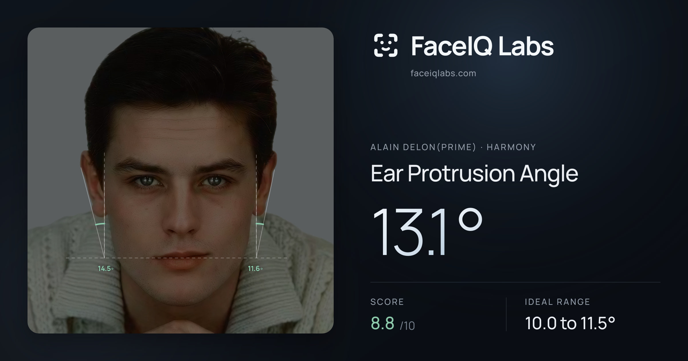 Alain Delon(prime) Ear Protrusion Angle: 13.1°, drawn on the photo