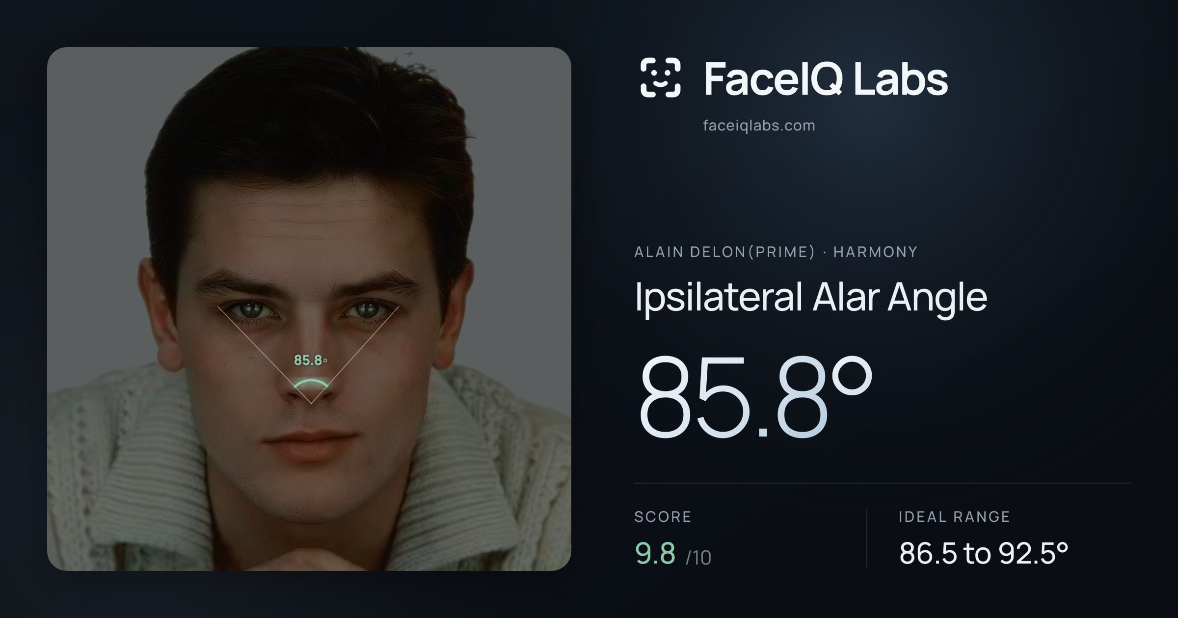 Alain Delon(prime) Ipsilateral Alar Angle: 85.8°, drawn on the photo