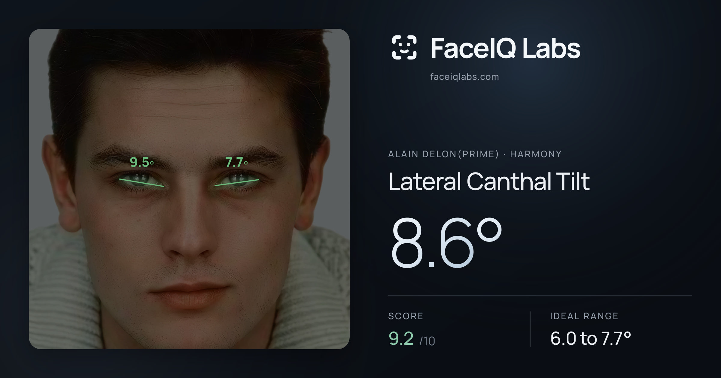 Alain Delon(prime) Lateral Canthal Tilt: 8.6°, drawn on the photo