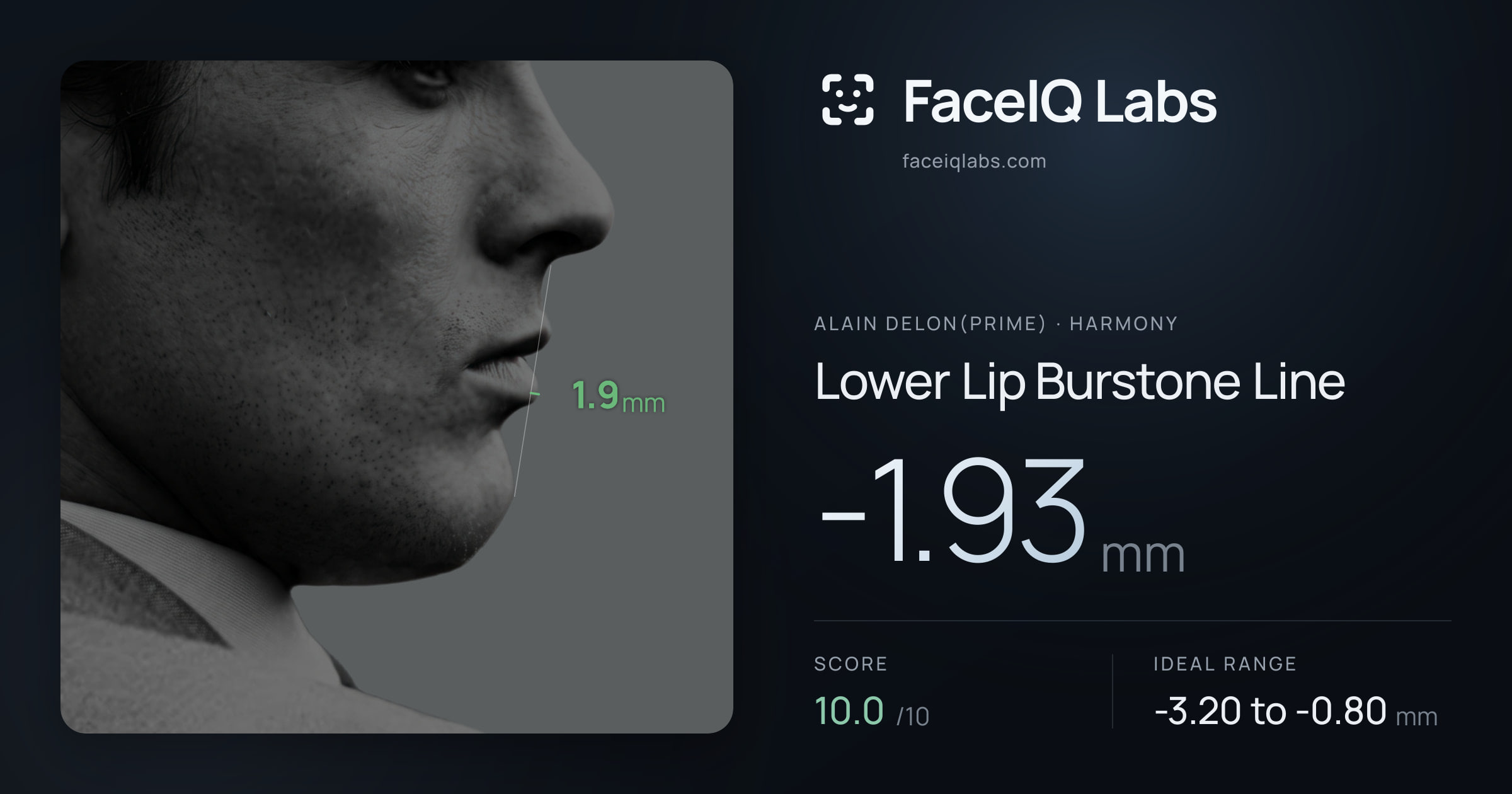 Alain Delon(prime) Lower Lip Burstone Line: -1.93mm, drawn on the photo
