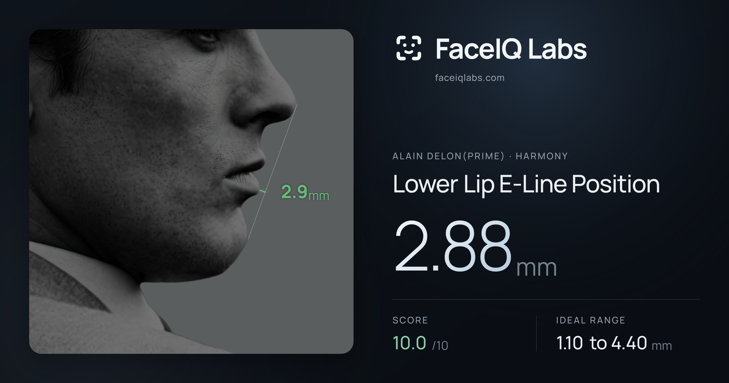 Alain Delon(prime) Lower Lip E-Line Position: 2.88mm, drawn on the photo