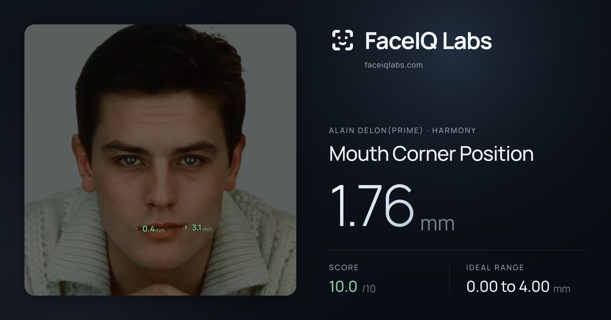 Alain Delon(prime) Mouth Corner Position: 1.76mm, drawn on the photo