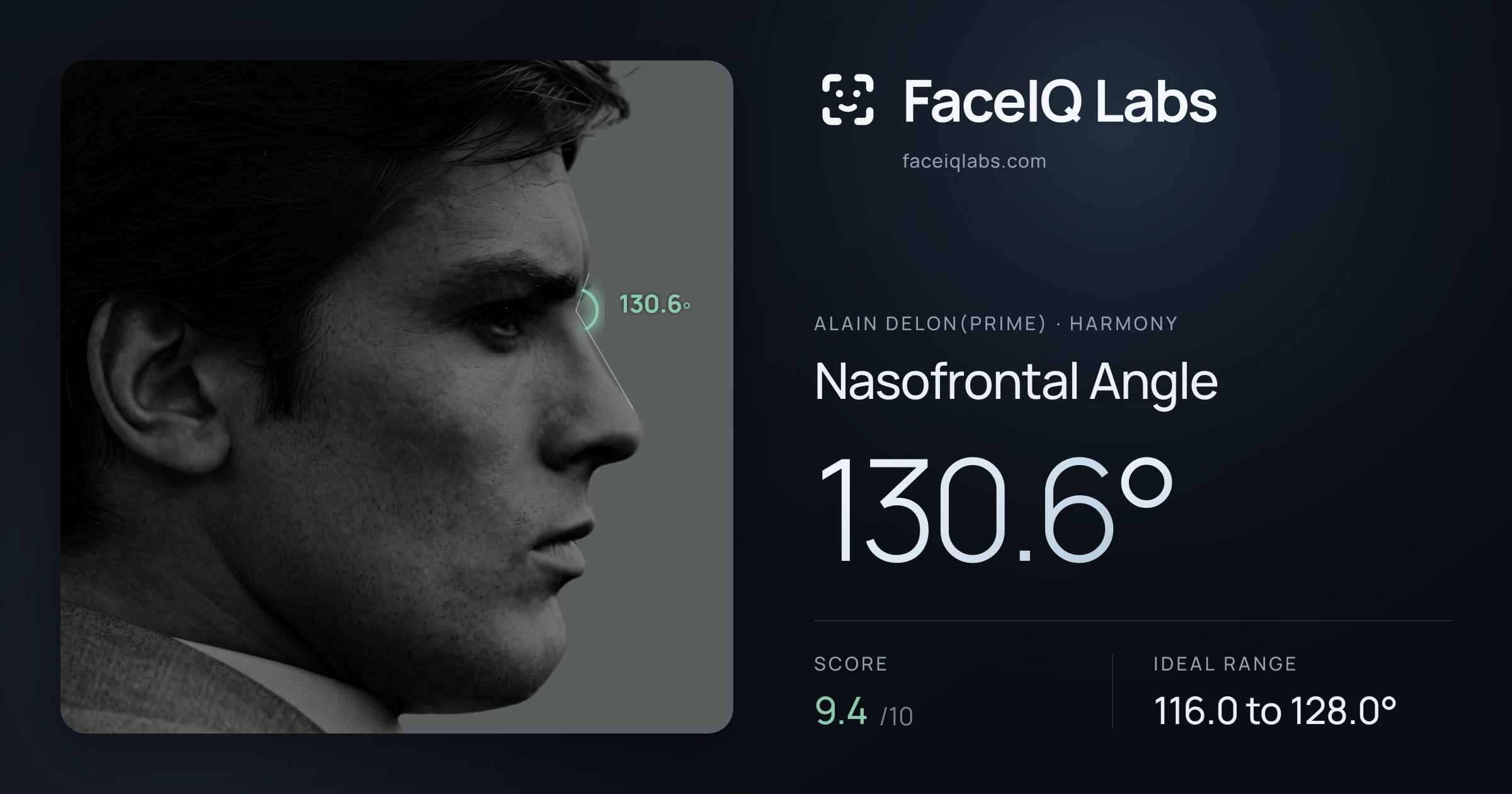 Alain Delon(prime) Nasofrontal Angle: 130.6°, drawn on the photo