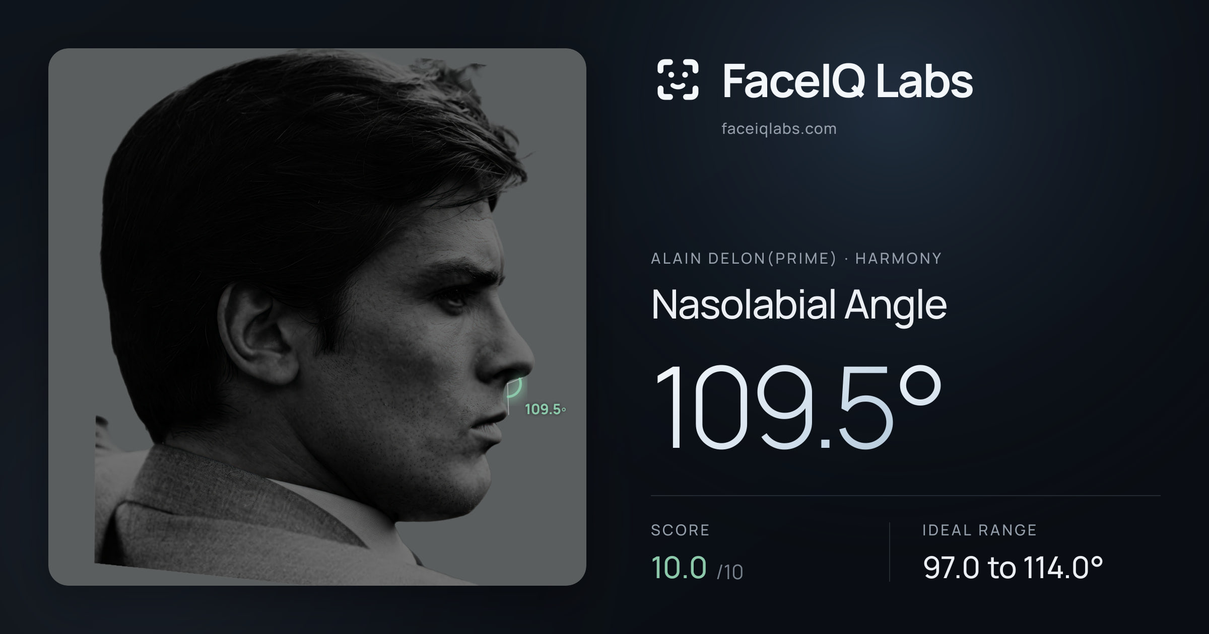 Alain Delon(prime) Nasolabial Angle: 109.5°, drawn on the photo