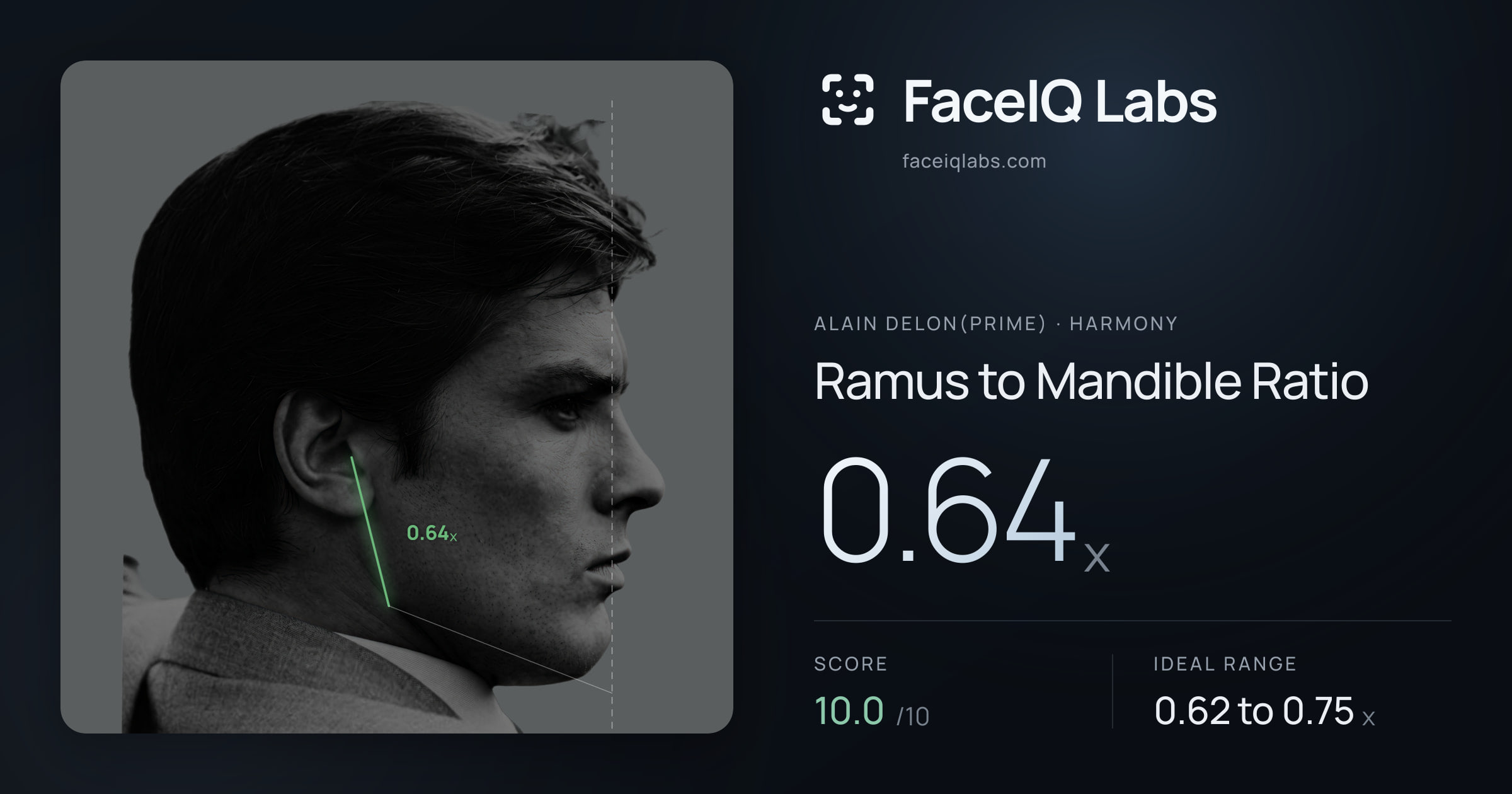 Alain Delon(prime) Ramus to Mandible Ratio: 0.64x, drawn on the photo
