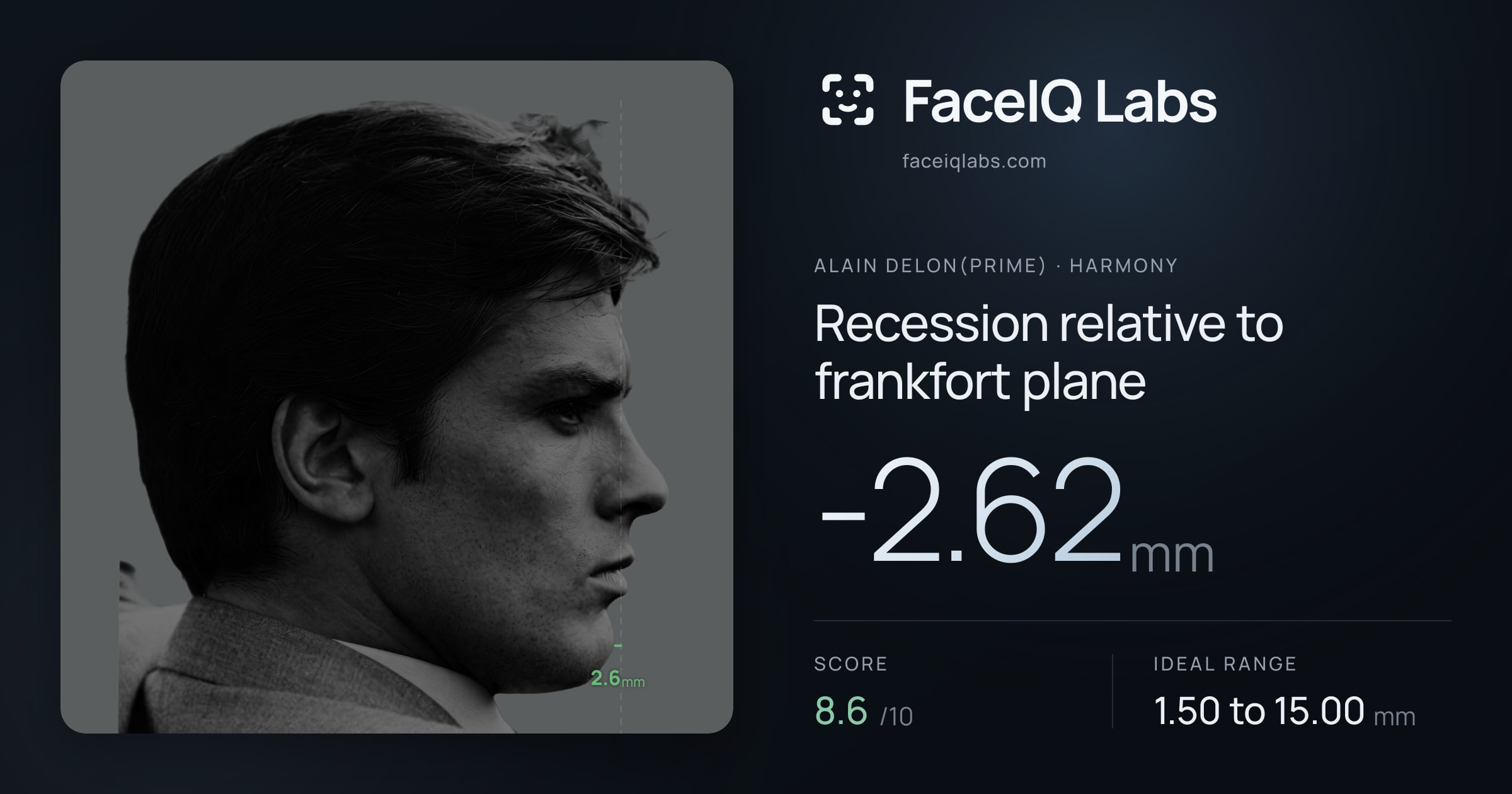 Alain Delon(prime) Recession relative to frankfort plane: -2.62mm, drawn on the photo