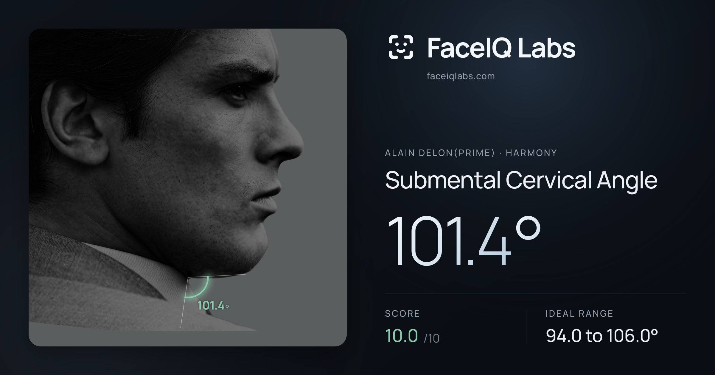 Alain Delon(prime) Submental Cervical Angle: 101.4°, drawn on the photo