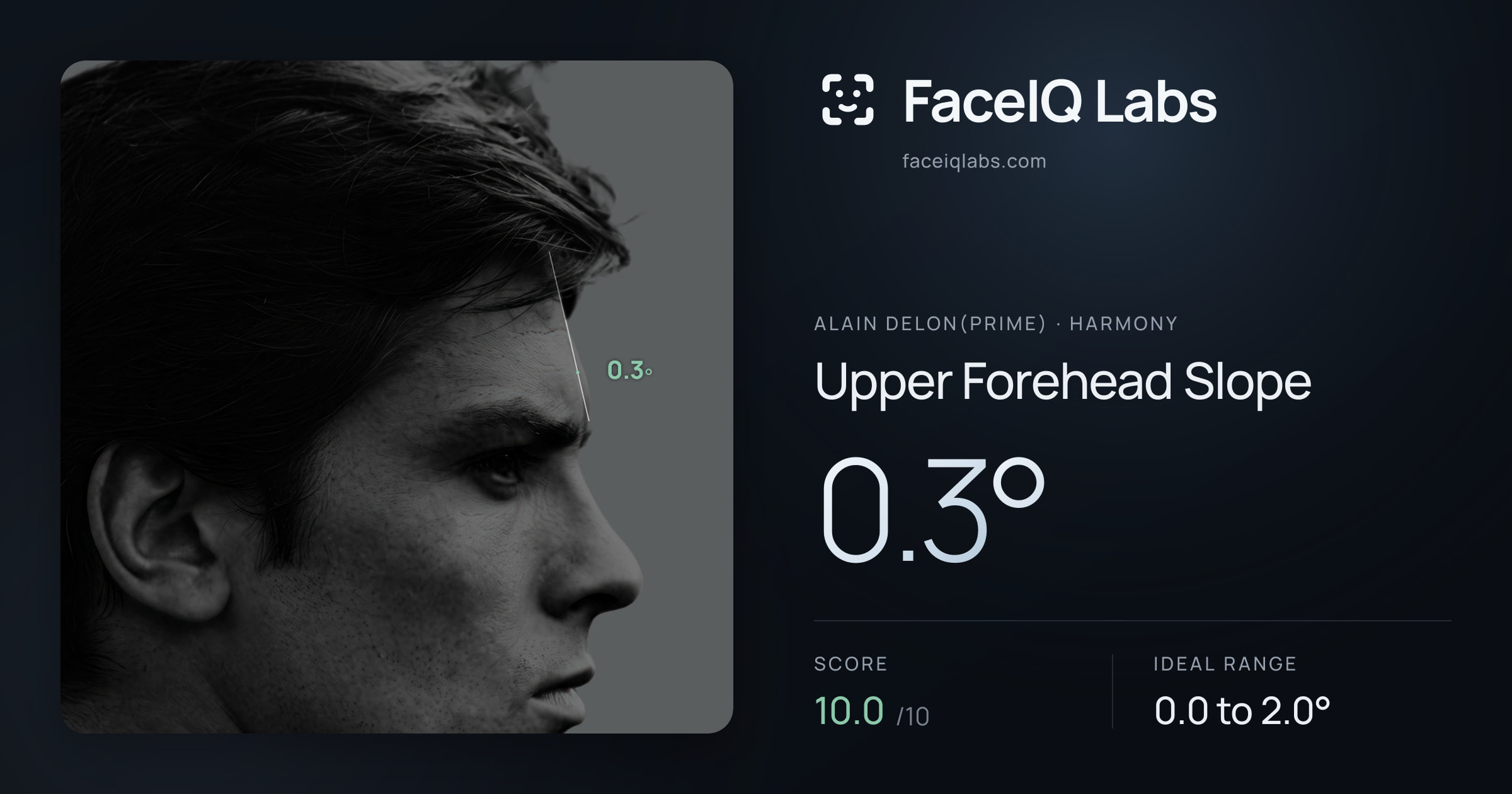 Alain Delon(prime) Upper Forehead Slope: 0.3°, drawn on the photo