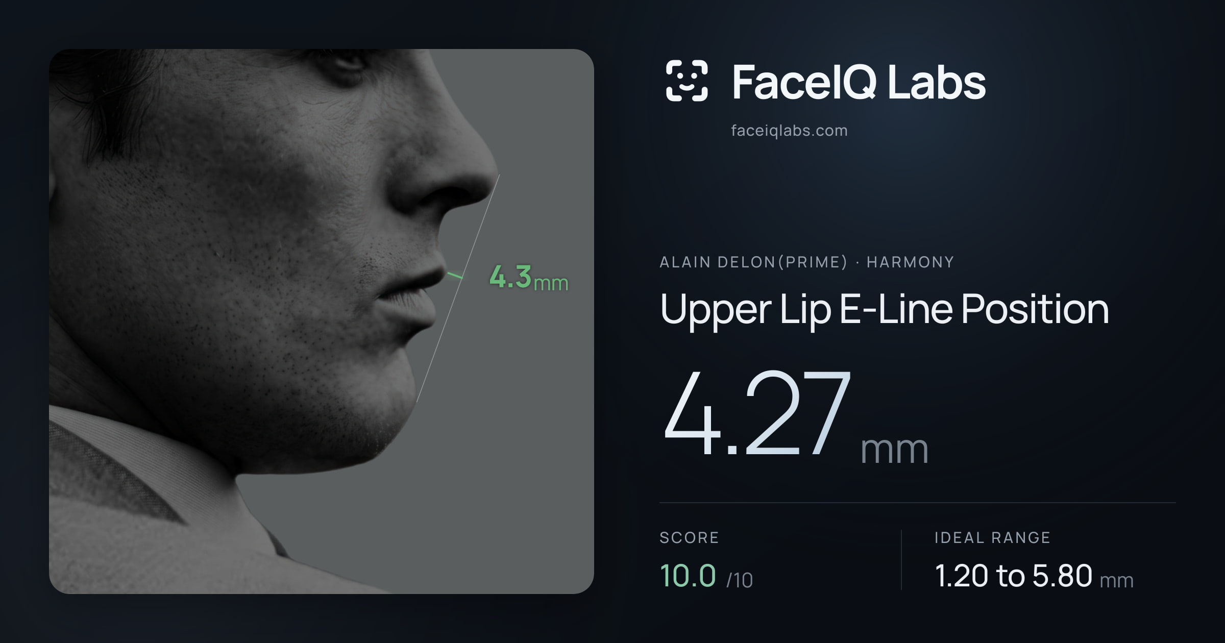 Alain Delon(prime) Upper Lip E-Line Position: 4.27mm, drawn on the photo