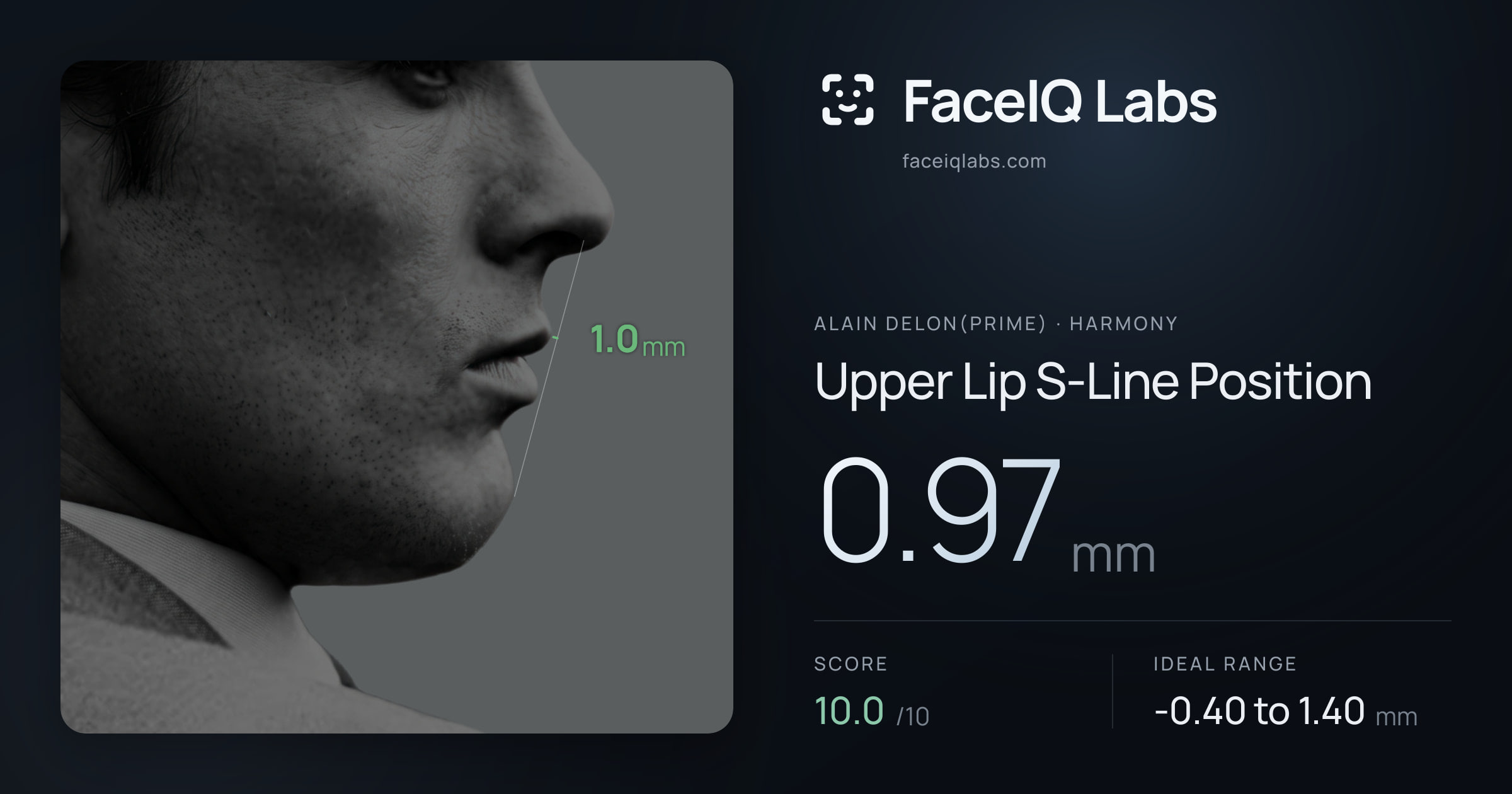 Alain Delon(prime) Upper Lip S-Line Position: 0.97mm, drawn on the photo