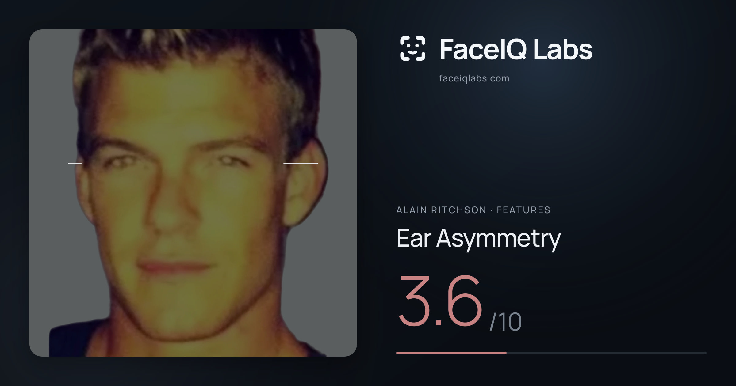 Alain Ritchson Ear Asymmetry: 3.6/10, drawn on the photo