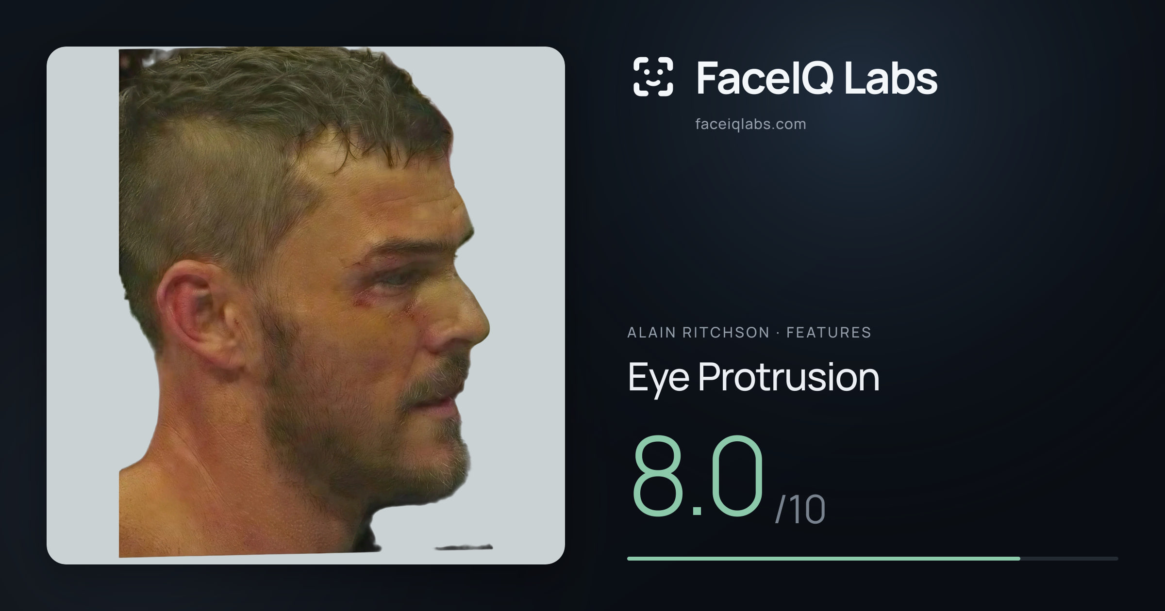 Alain Ritchson Eye Protrusion: 8.0/10, drawn on the photo