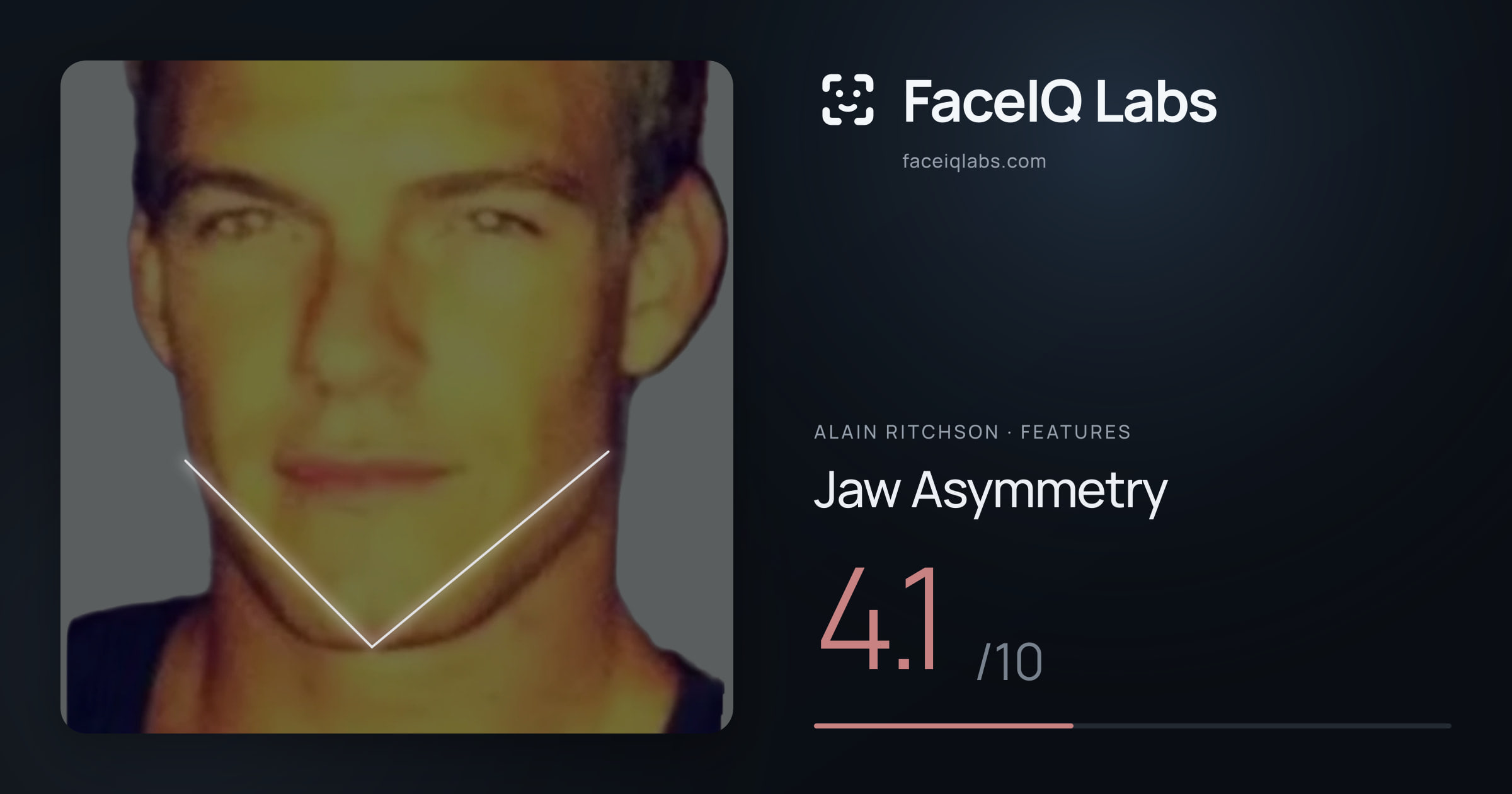 Alain Ritchson Jaw Asymmetry: 4.1/10, drawn on the photo