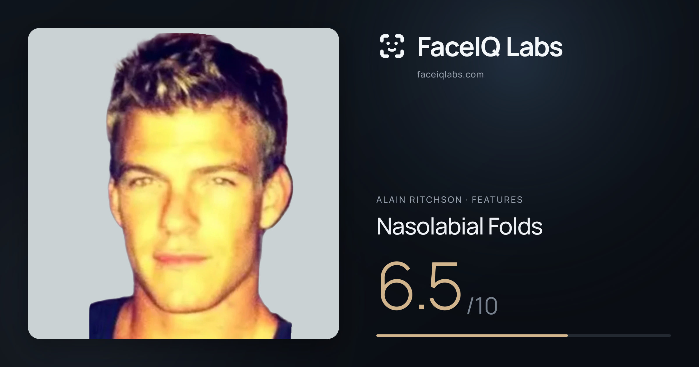 Alain Ritchson Nasolabial Folds: 6.5/10, drawn on the photo