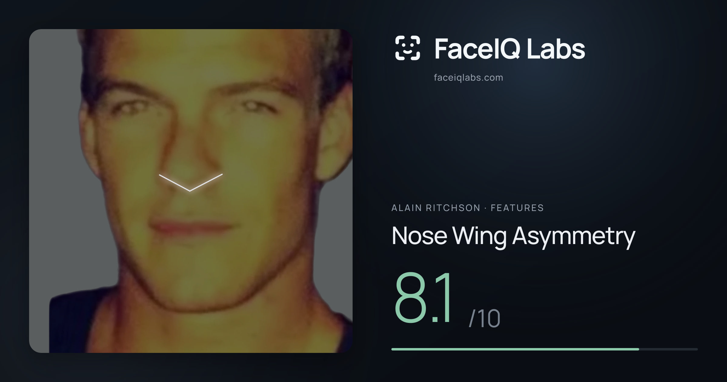 Alain Ritchson Nose Wing Asymmetry: 8.1/10, drawn on the photo