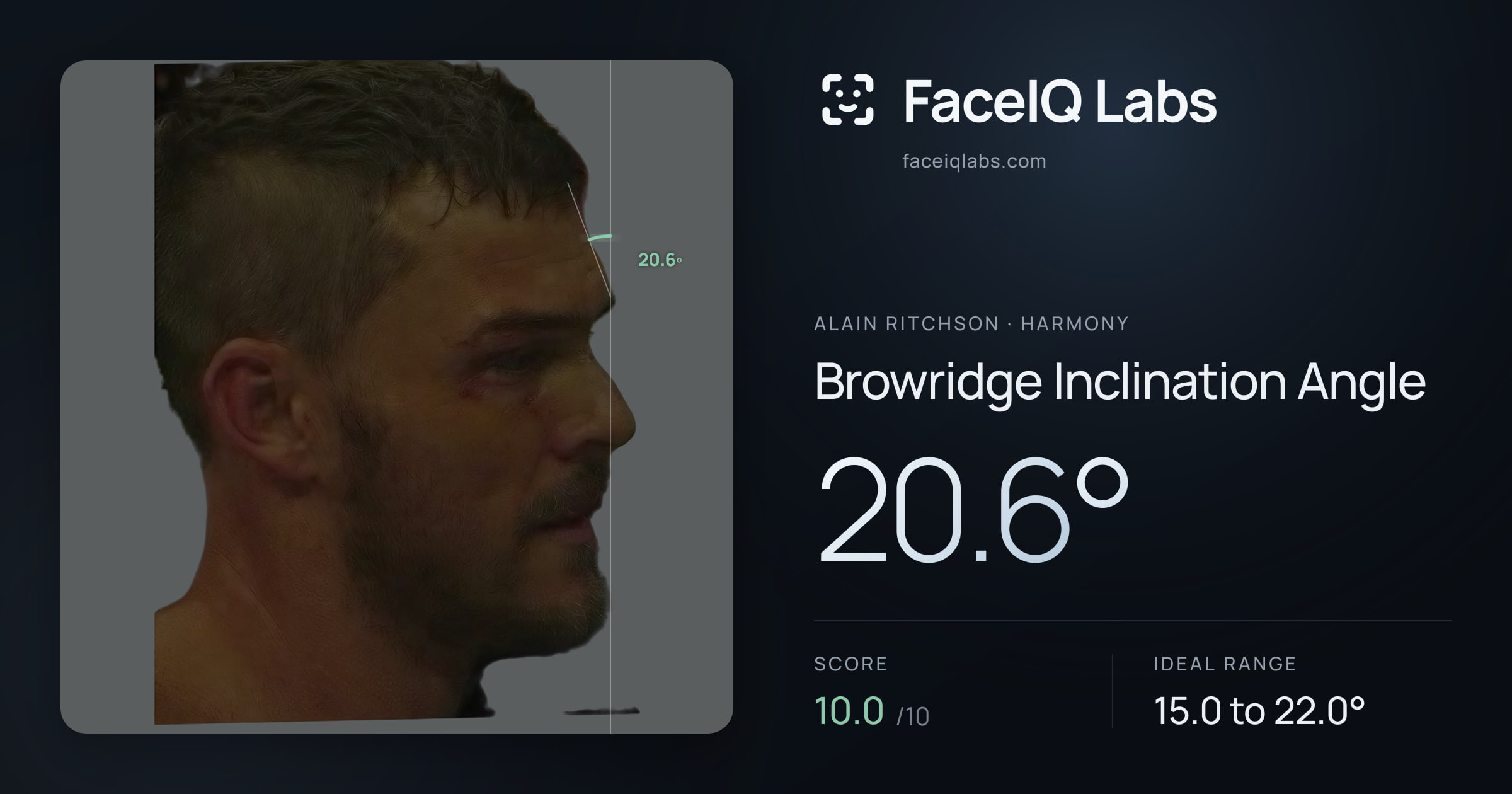 Alain Ritchson Browridge Inclination Angle: 20.6°, drawn on the photo