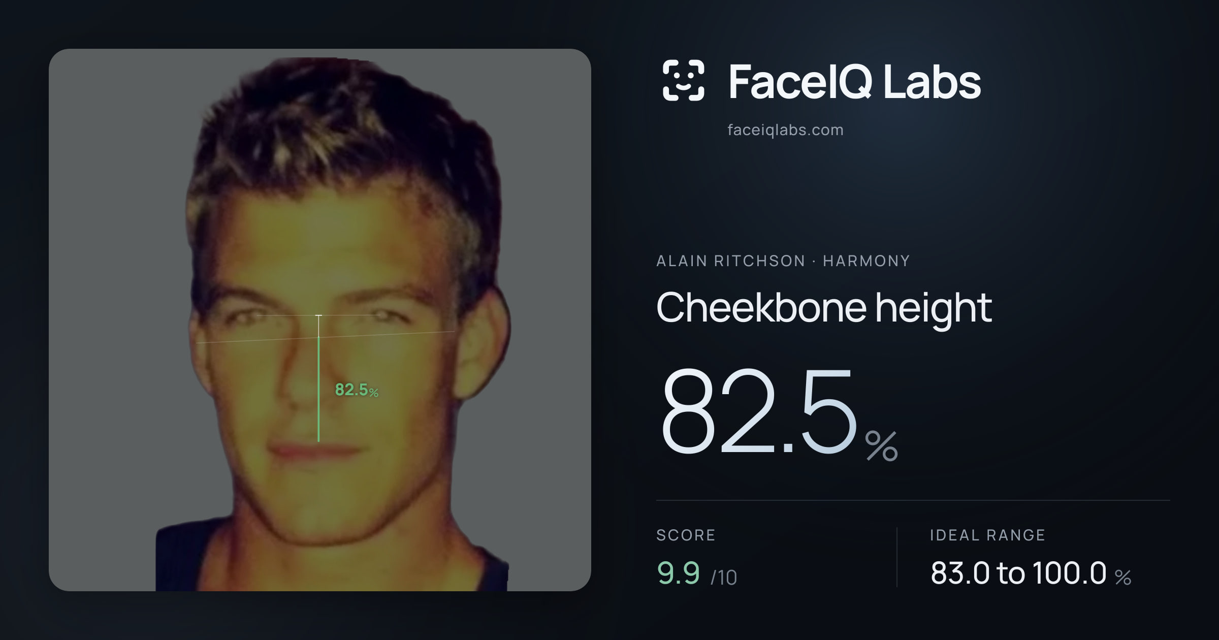 Alain Ritchson Cheekbone height: 82.5%, drawn on the photo