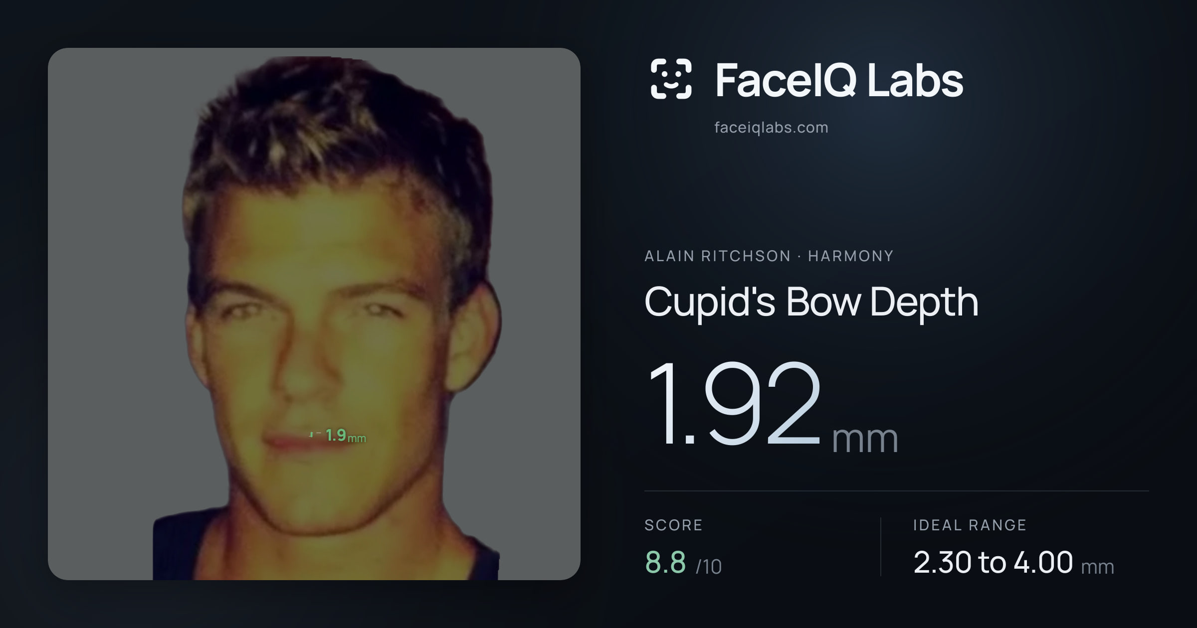 Alain Ritchson Cupid's Bow Depth: 1.92mm, drawn on the photo