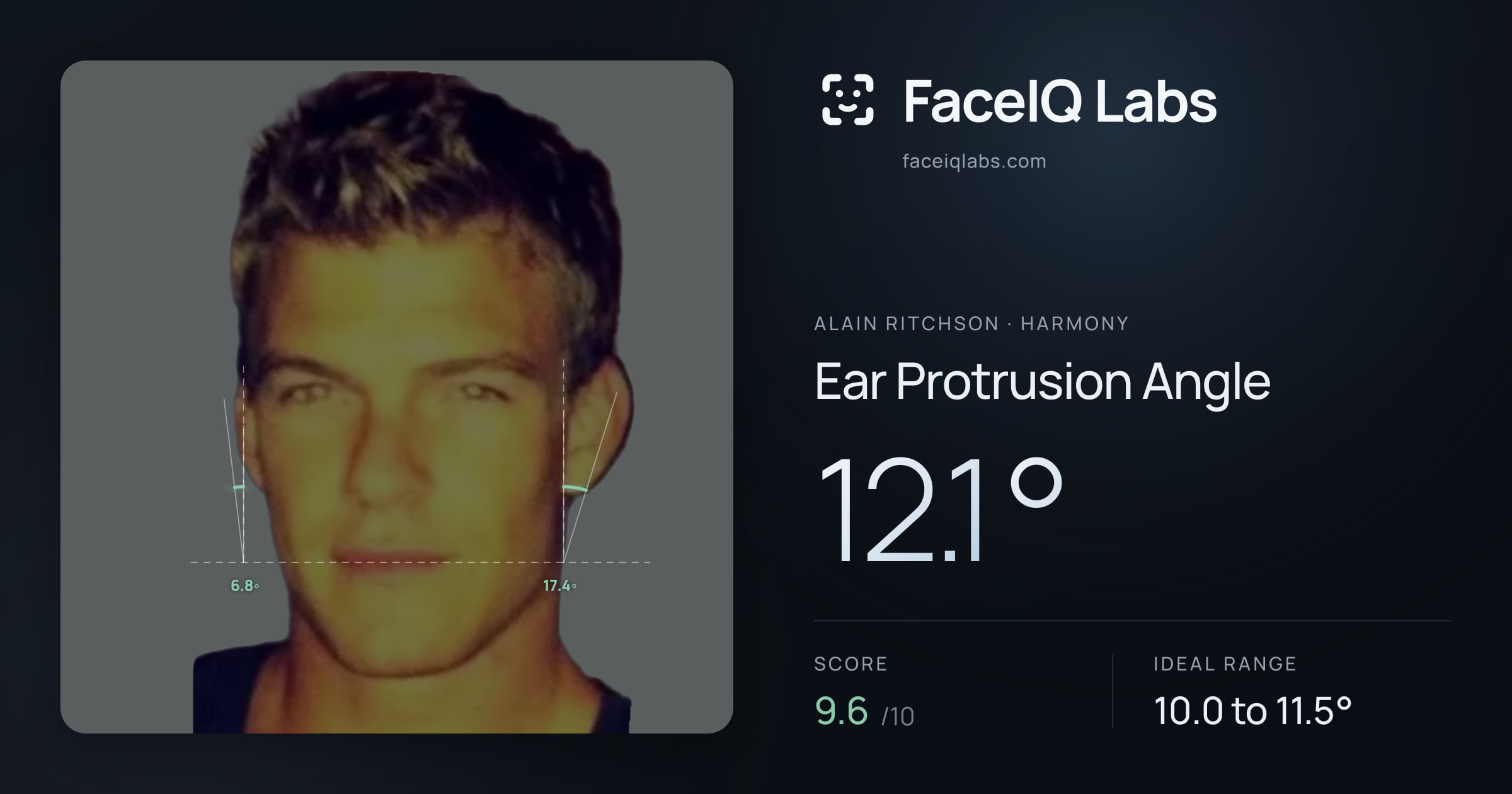 Alain Ritchson Ear Protrusion Angle: 12.1°, drawn on the photo