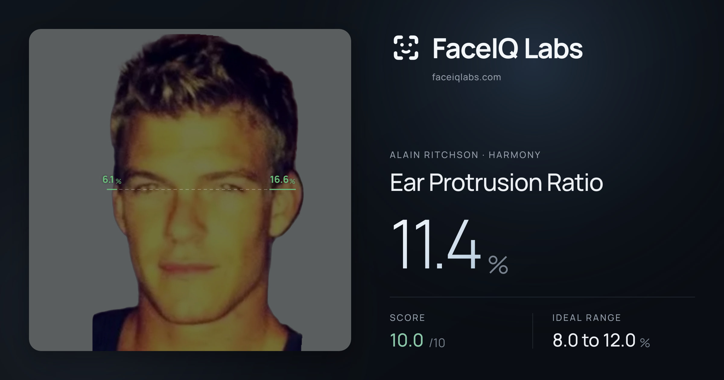 Alain Ritchson Ear Protrusion Ratio: 11.4%, drawn on the photo
