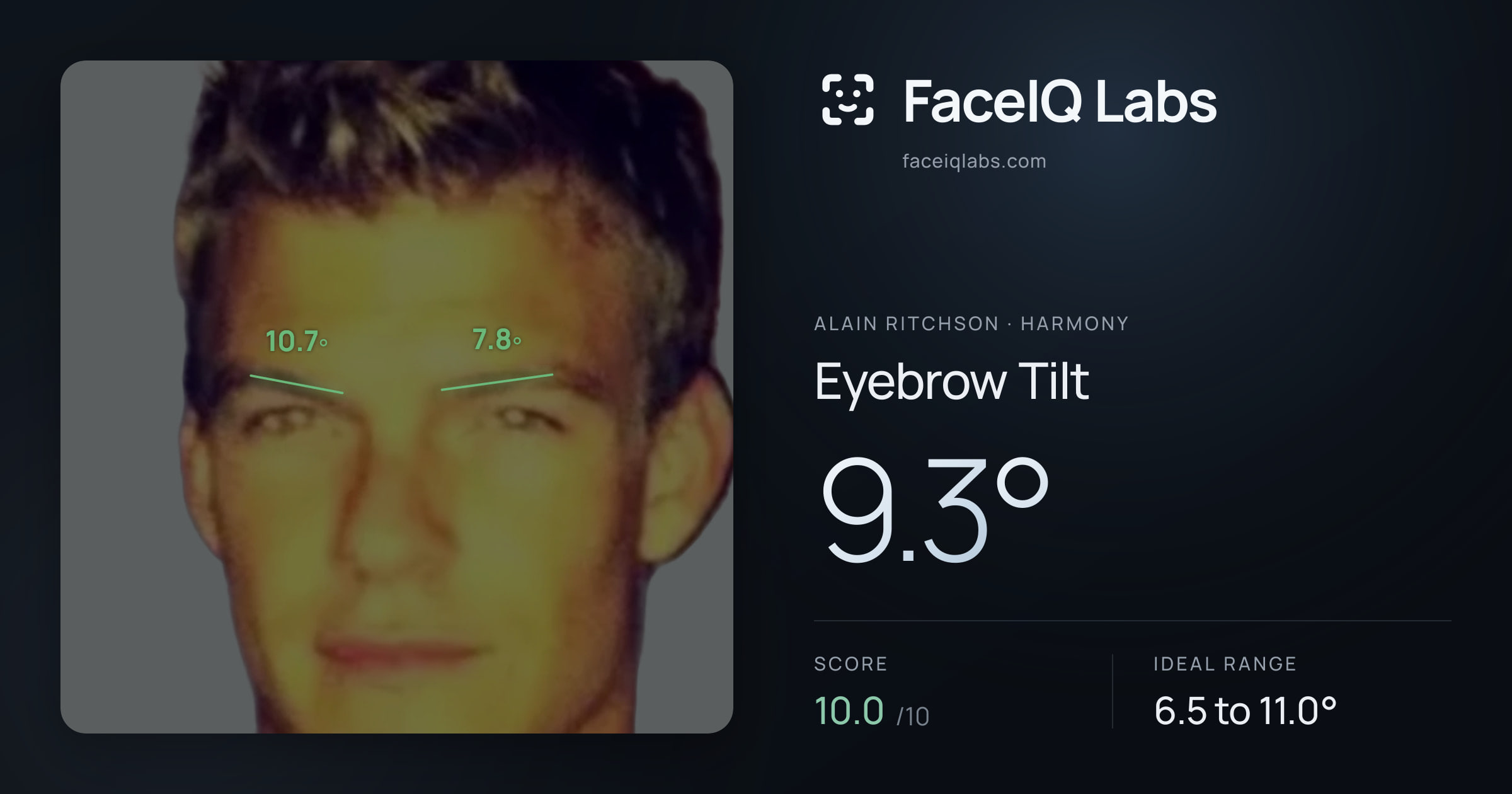 Alain Ritchson Eyebrow Tilt: 9.3°, drawn on the photo