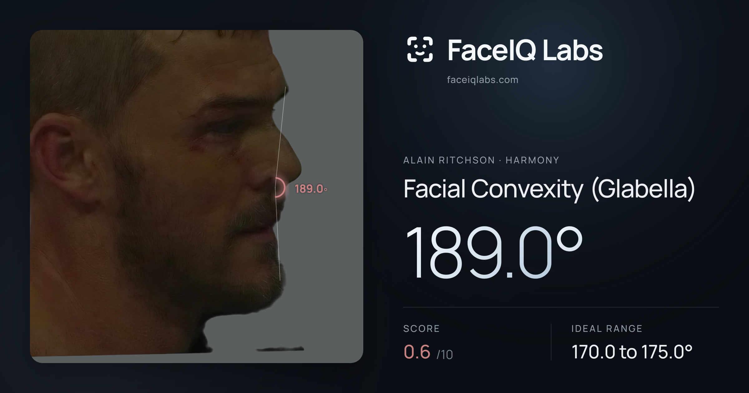 Alain Ritchson Facial Convexity (Glabella): 189.0°, drawn on the photo