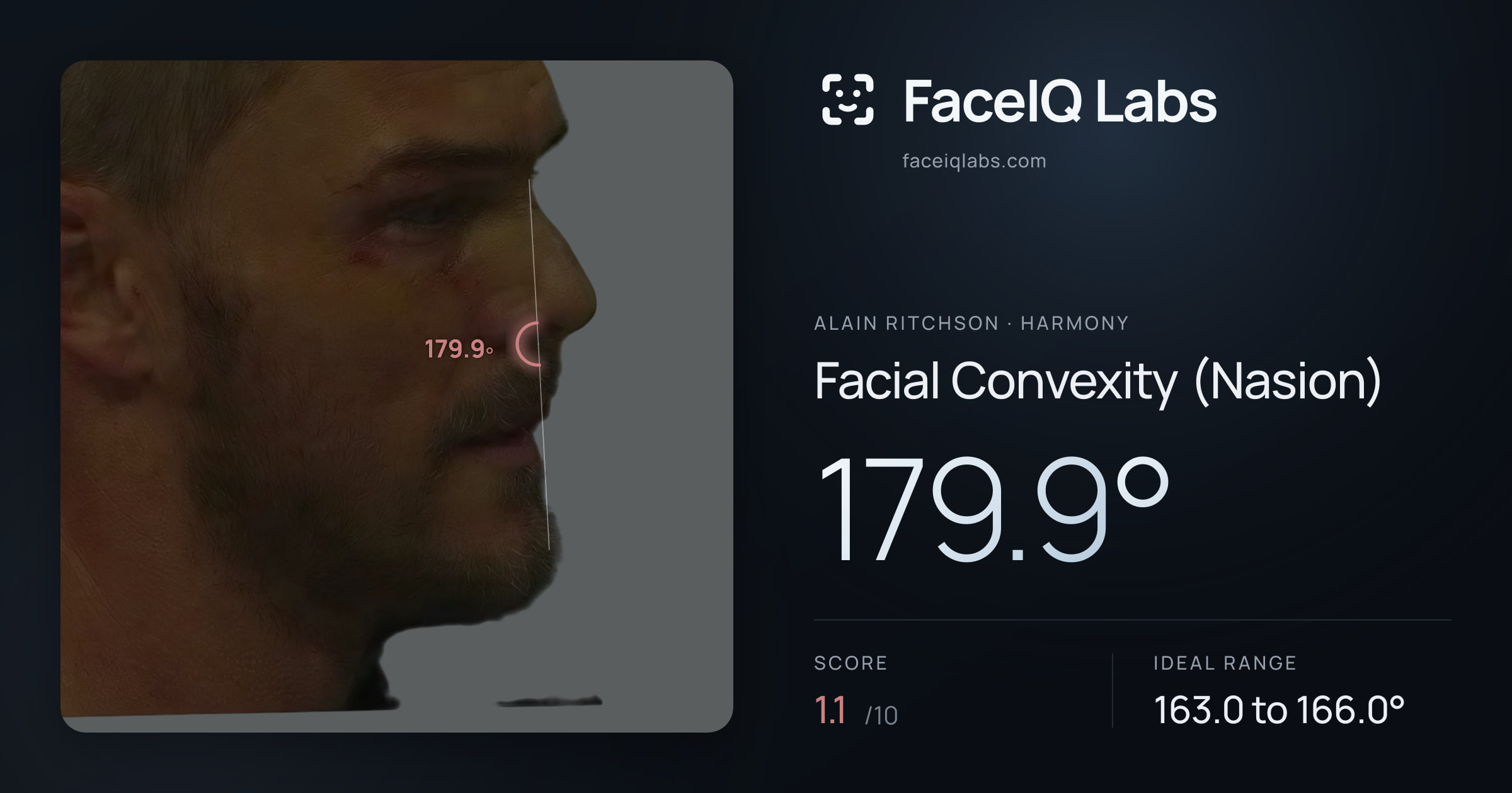 Alain Ritchson Facial Convexity (Nasion): 179.9°, drawn on the photo