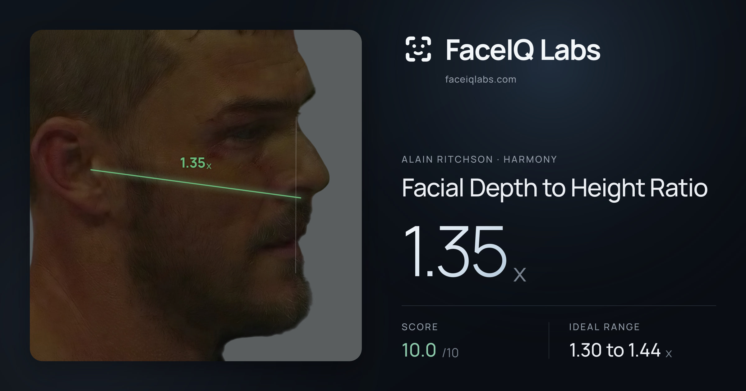 Alain Ritchson Facial Depth to Height Ratio: 1.35x, drawn on the photo