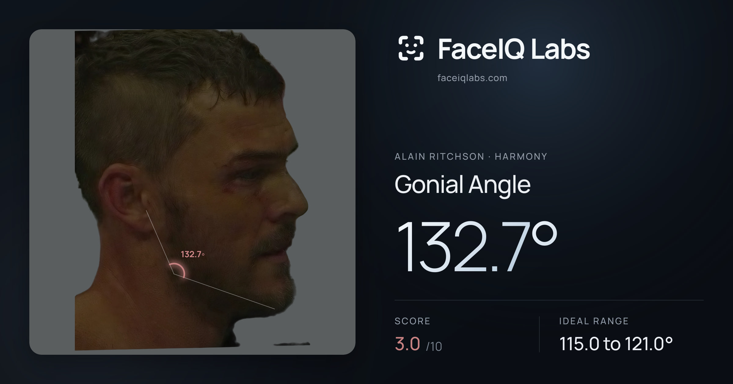 Alain Ritchson Gonial Angle: 132.7°, drawn on the photo