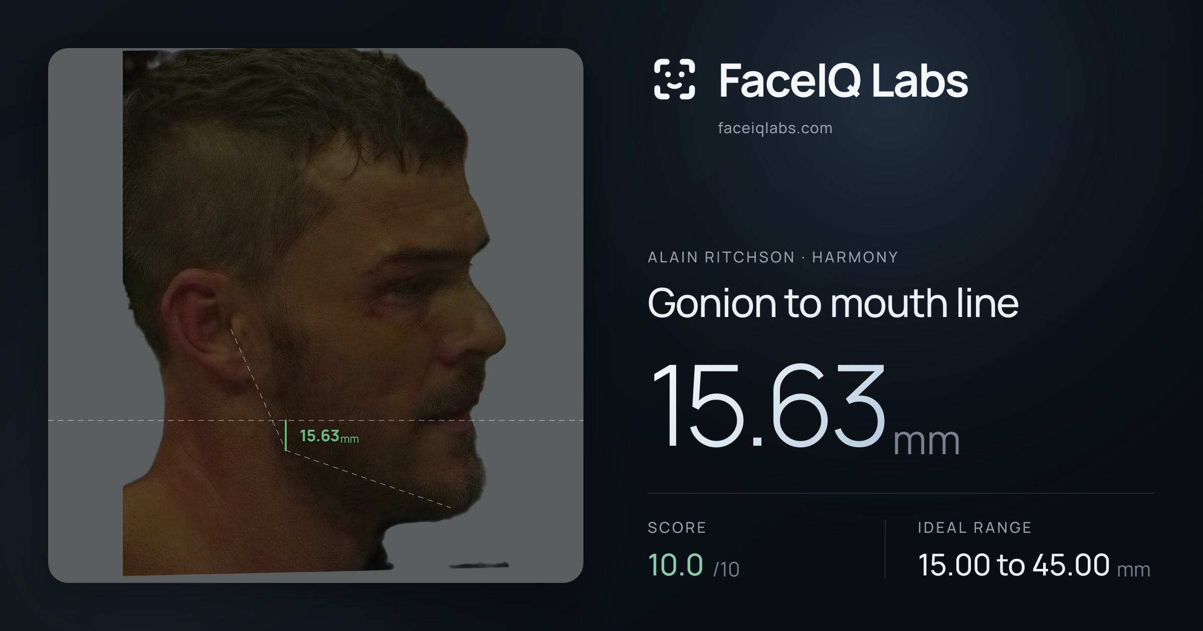 Alain Ritchson Gonion to mouth line: 15.63mm, drawn on the photo
