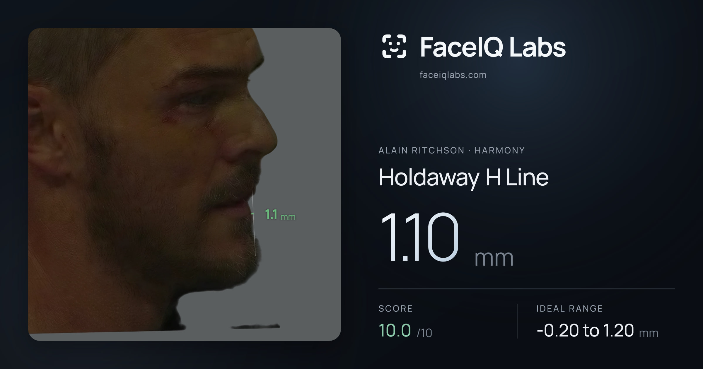 Alain Ritchson Holdaway H Line: 1.10mm, drawn on the photo