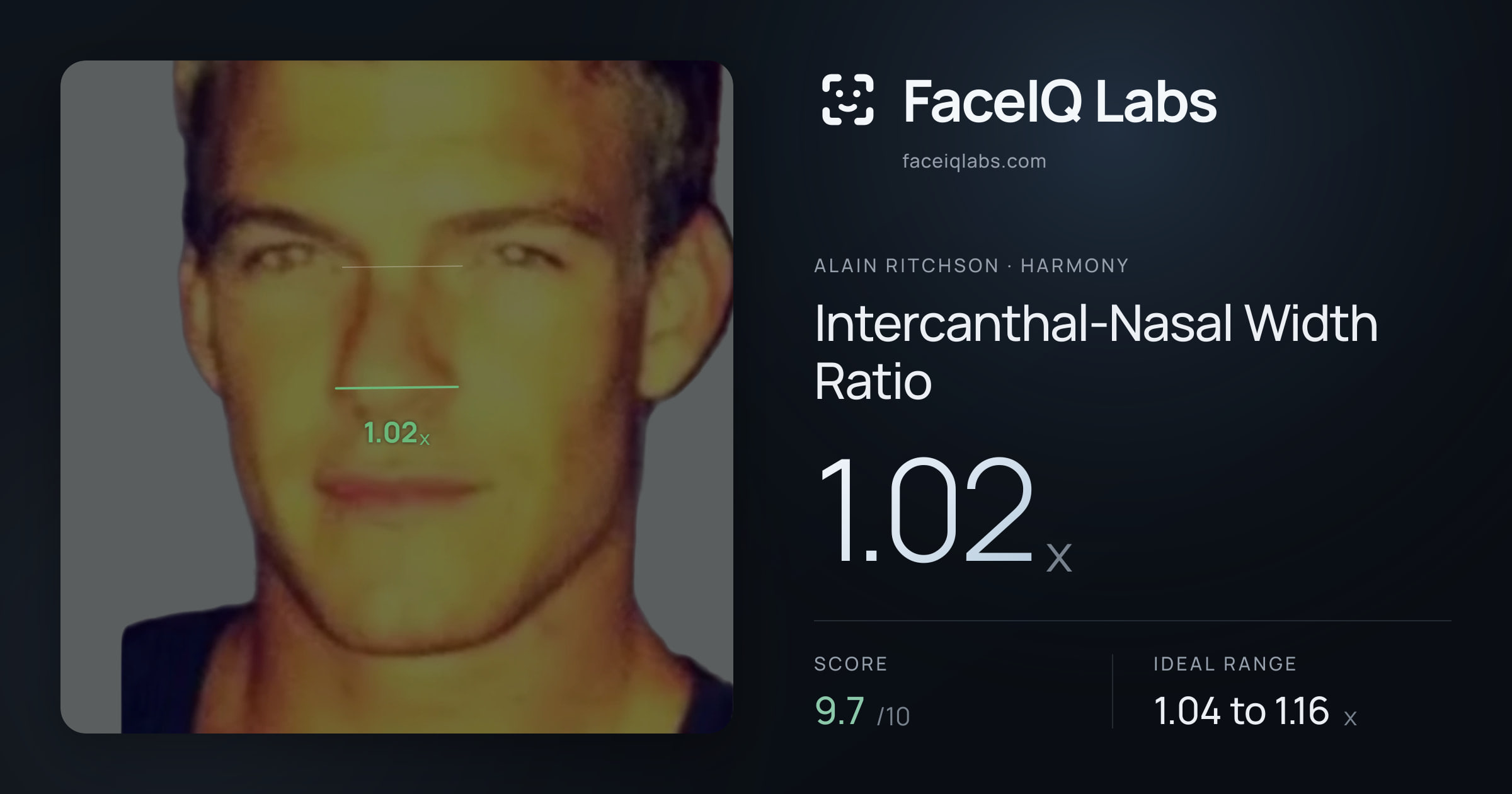 Alain Ritchson Intercanthal-Nasal Width Ratio: 1.02x, drawn on the photo