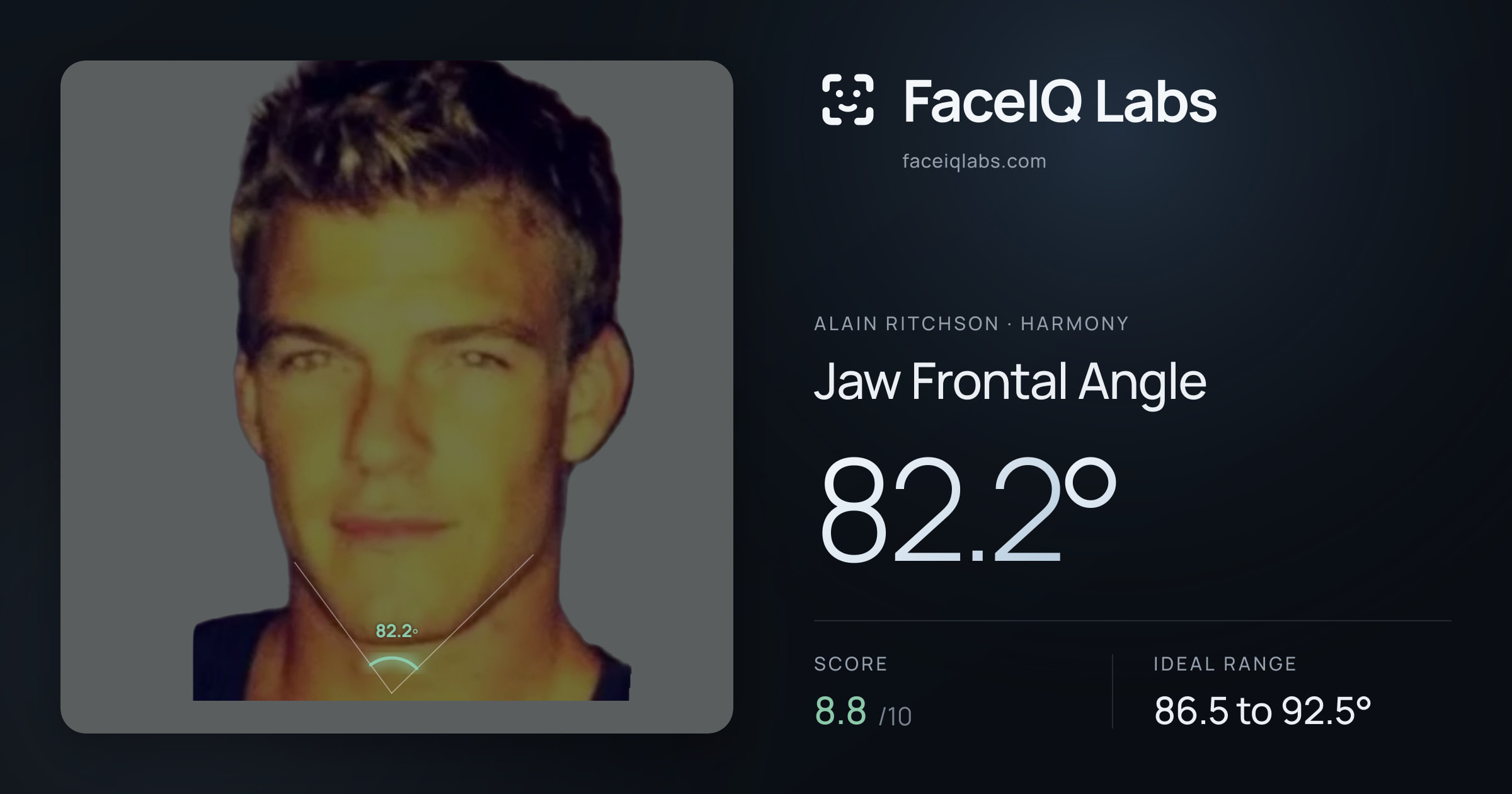 Alain Ritchson Jaw Frontal Angle: 82.2°, drawn on the photo