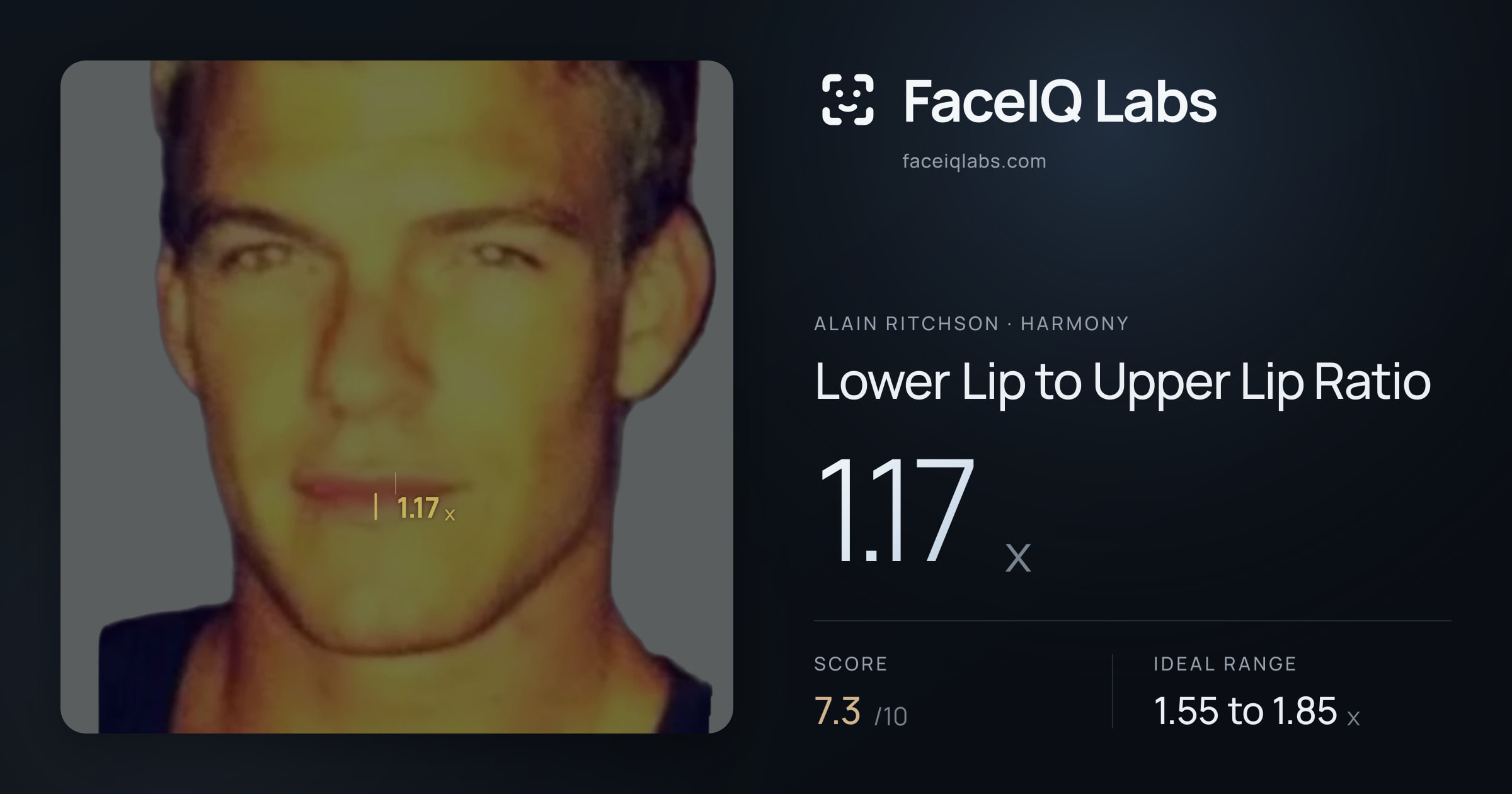 Alain Ritchson Lower Lip to Upper Lip Ratio: 1.17x, drawn on the photo
