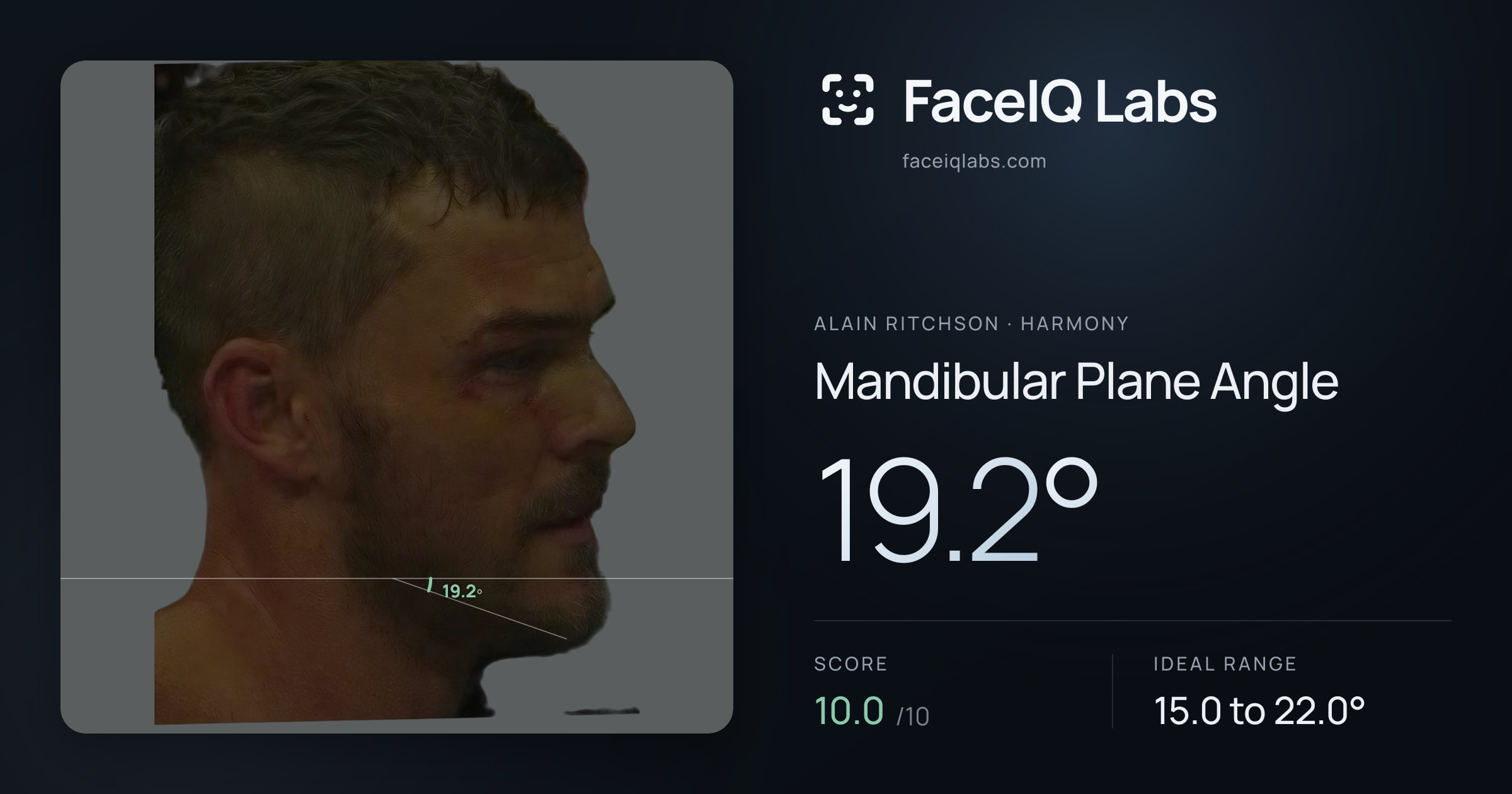 Alain Ritchson Mandibular Plane Angle: 19.2°, drawn on the photo