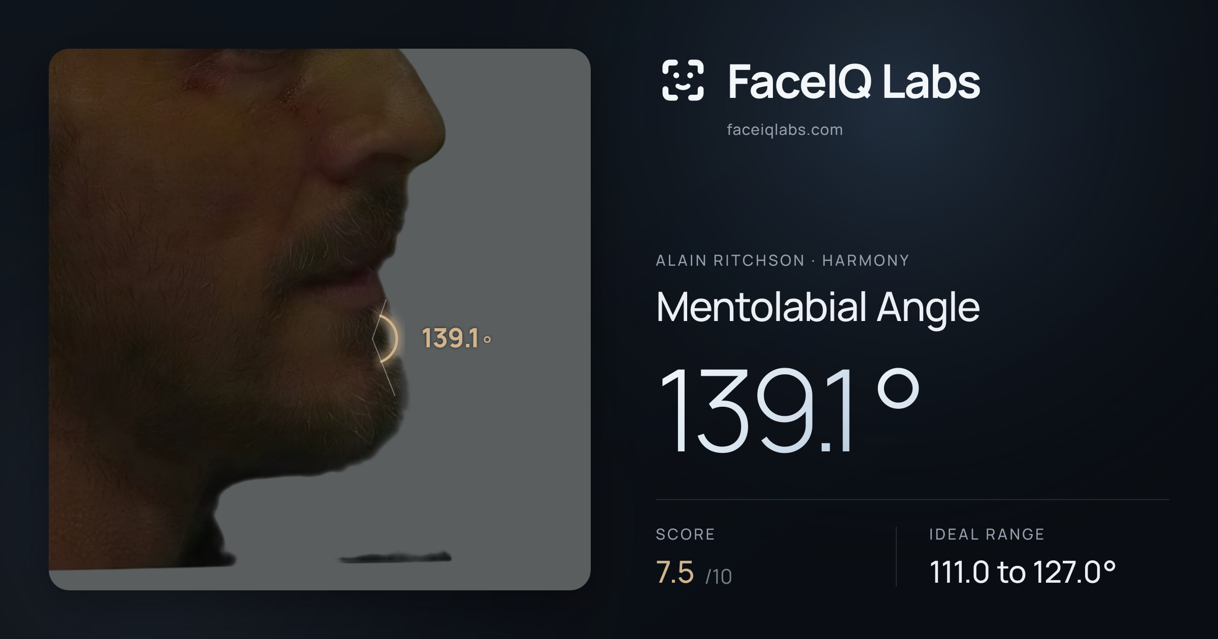 Alain Ritchson Mentolabial Angle: 139.1°, drawn on the photo