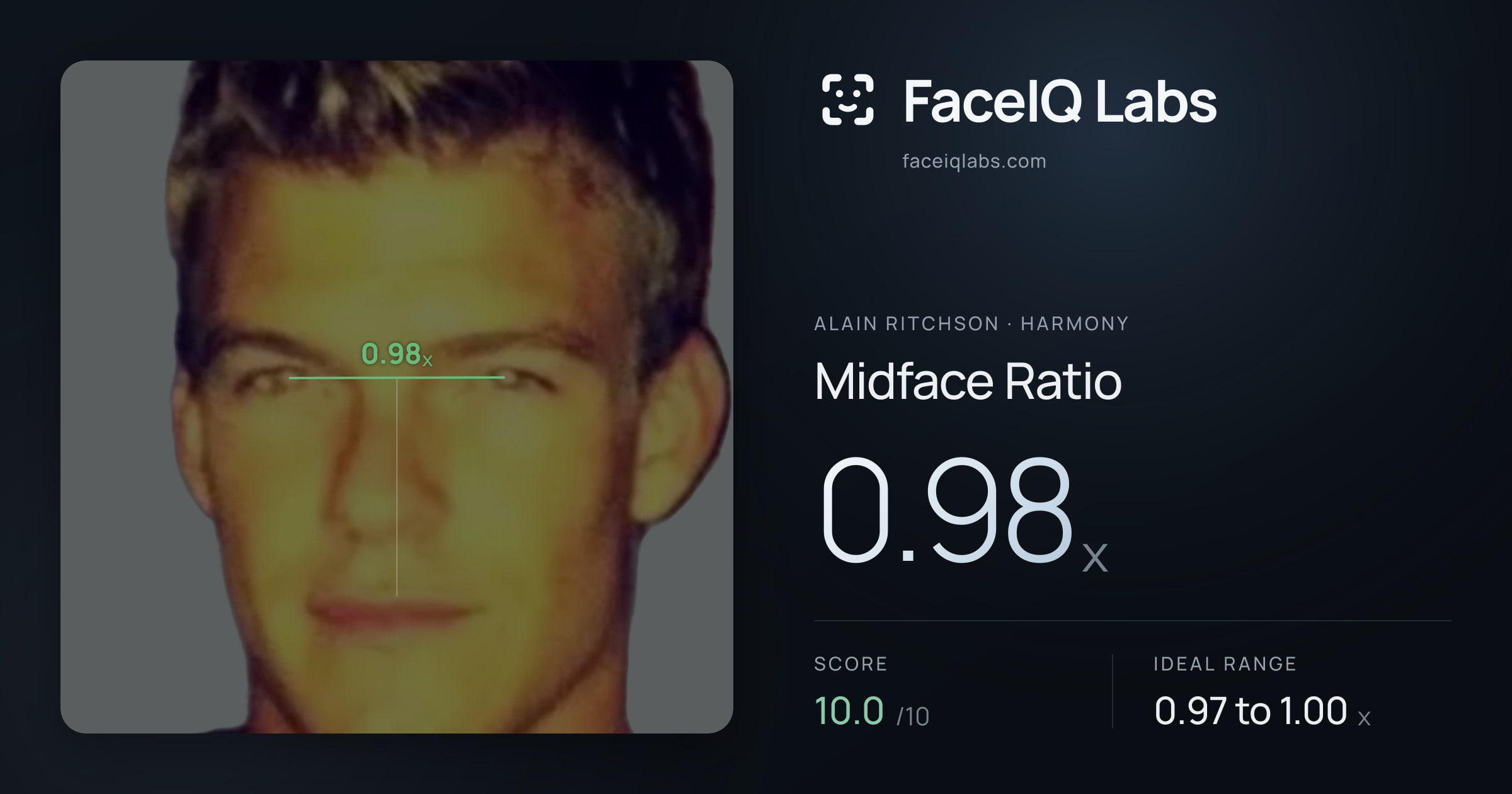 Alain Ritchson Midface Ratio: 0.98x, drawn on the photo