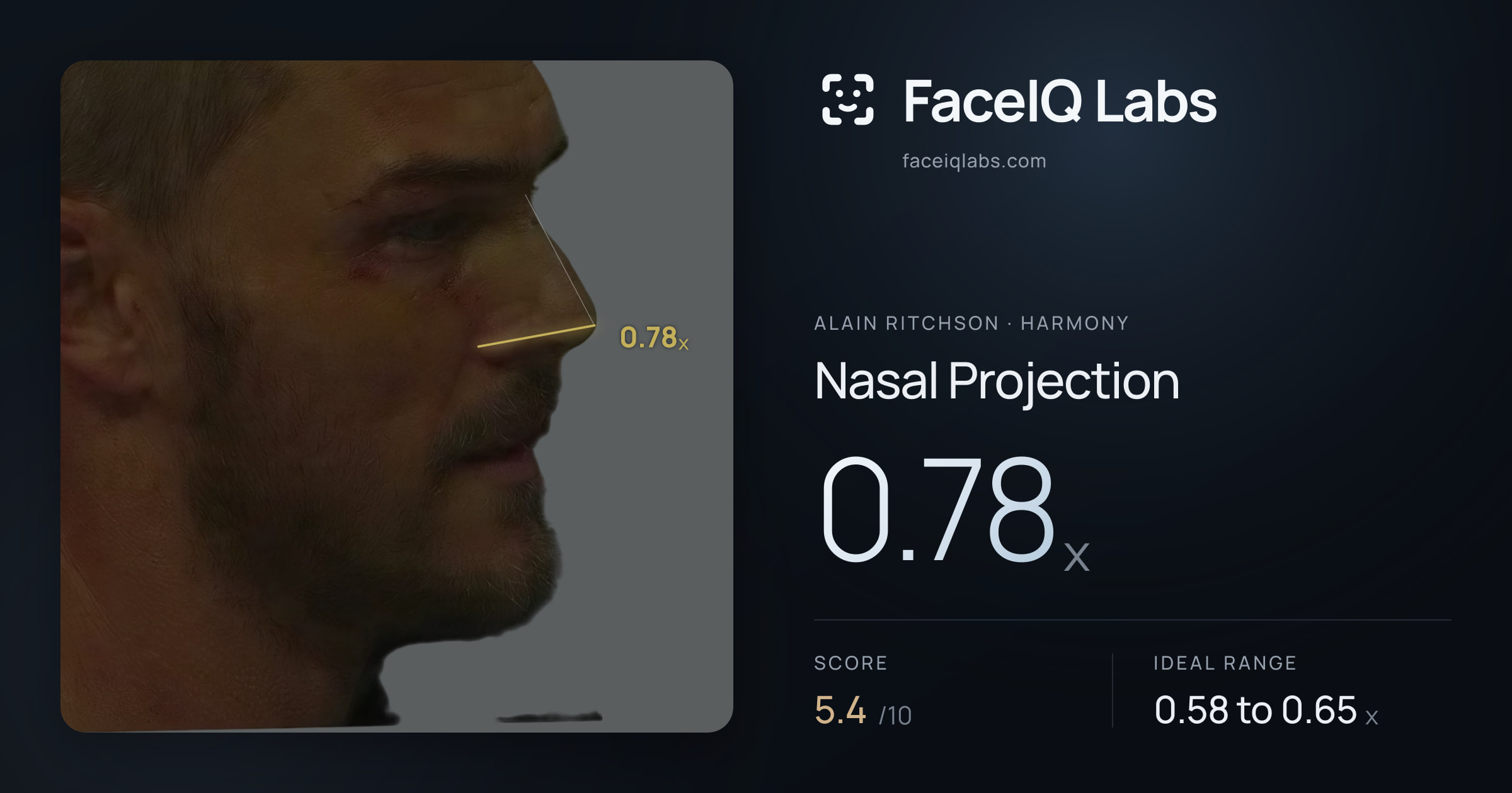 Alain Ritchson Nasal Projection: 0.78x, drawn on the photo