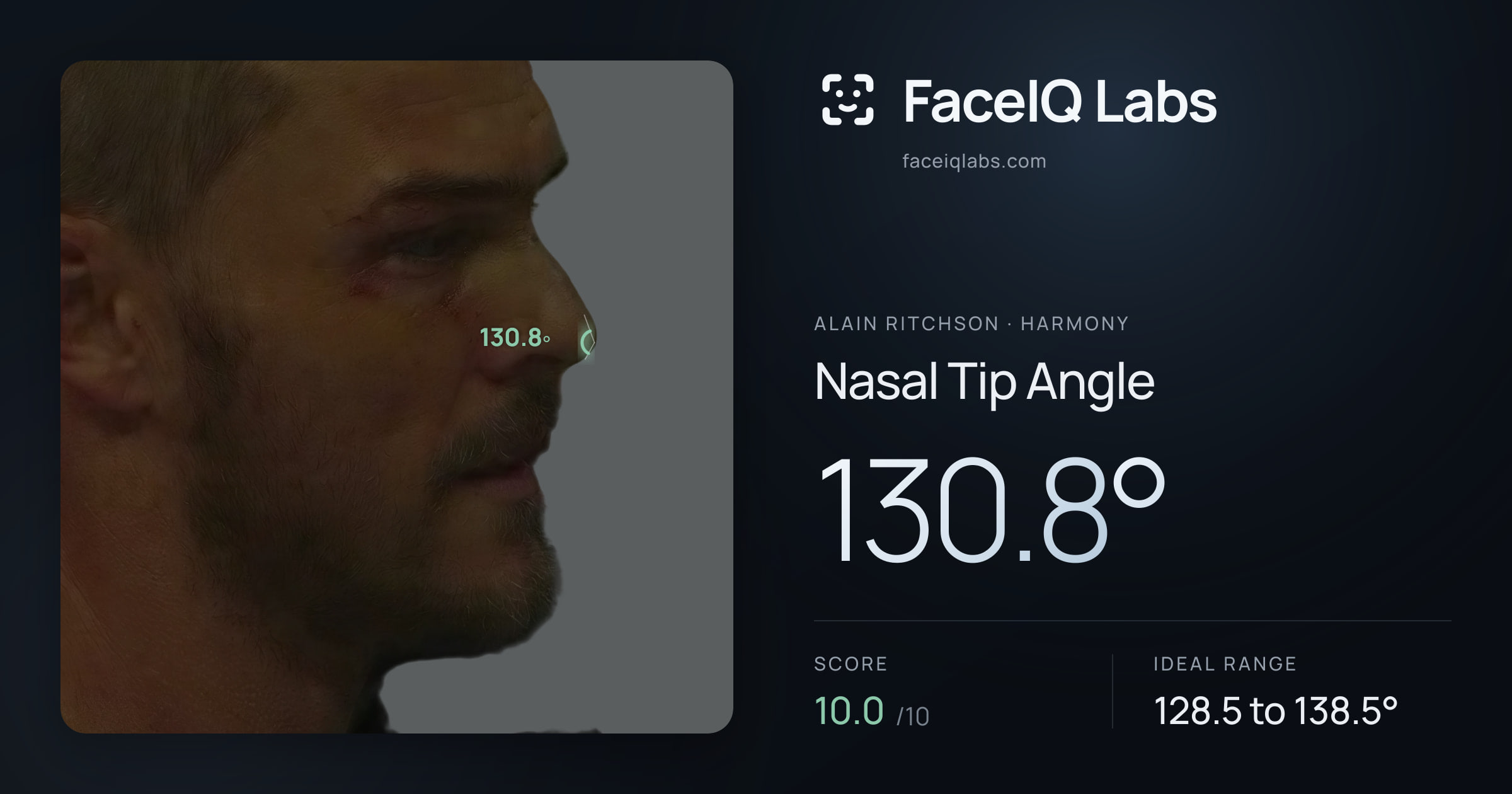 Alain Ritchson Nasal Tip Angle: 130.8°, drawn on the photo