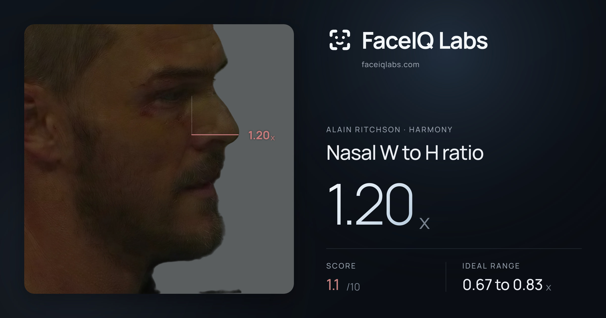 Alain Ritchson Nasal W to H ratio: 1.20x, drawn on the photo
