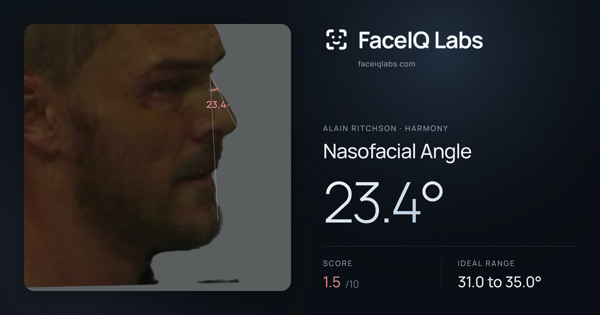 Alain Ritchson Nasofacial Angle: 23.4°, drawn on the photo