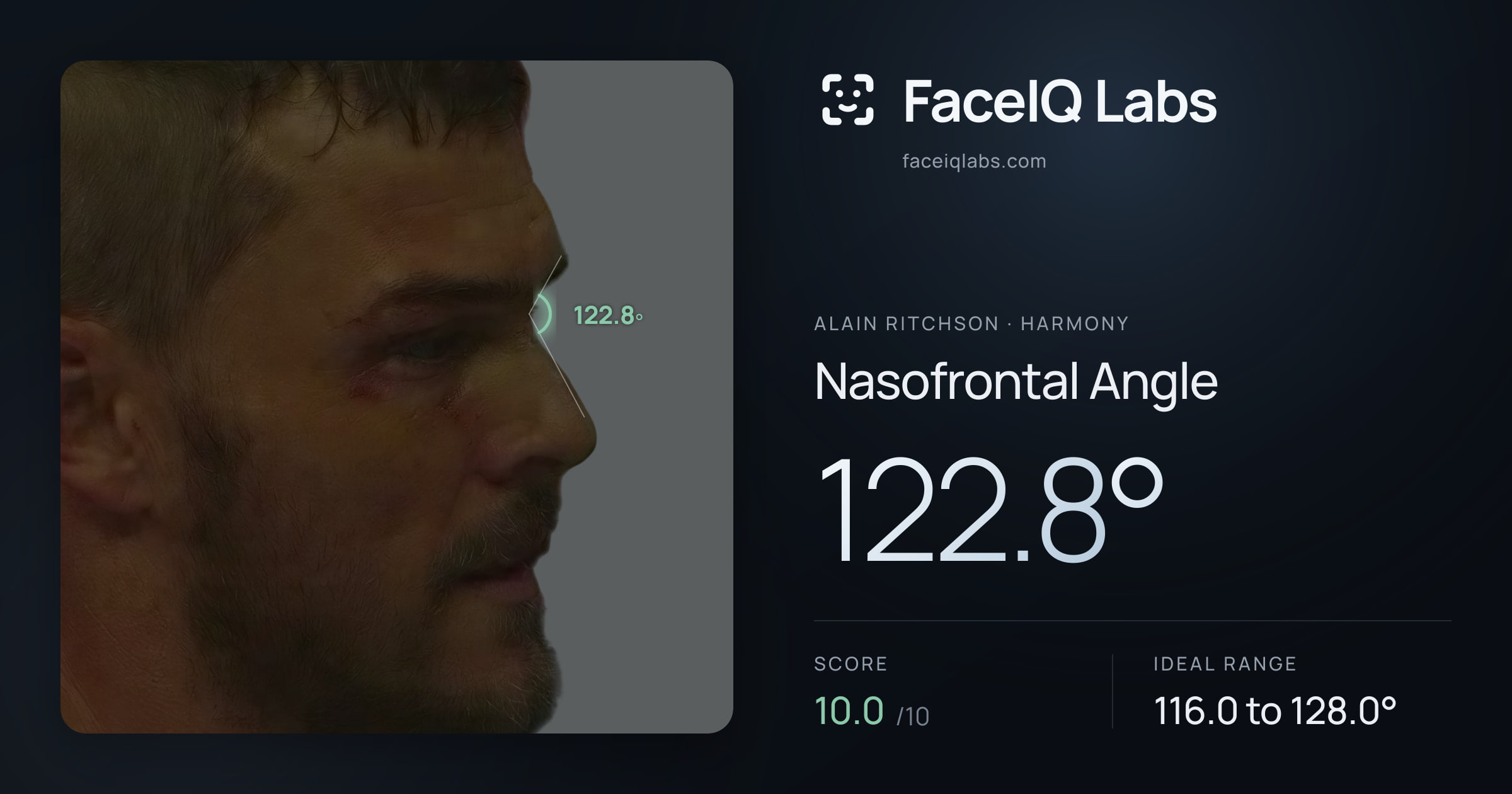 Alain Ritchson Nasofrontal Angle: 122.8°, drawn on the photo