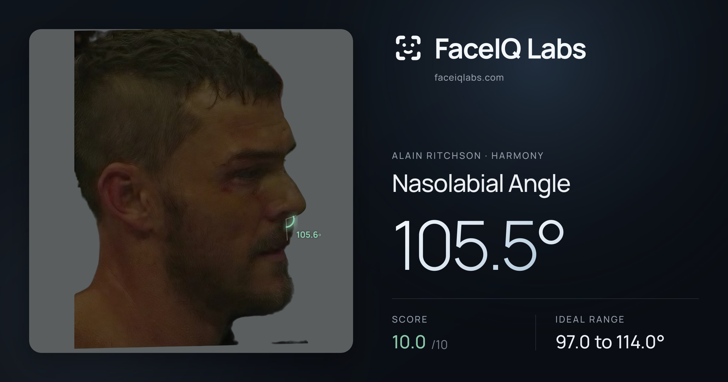 Alain Ritchson Nasolabial Angle: 105.5°, drawn on the photo