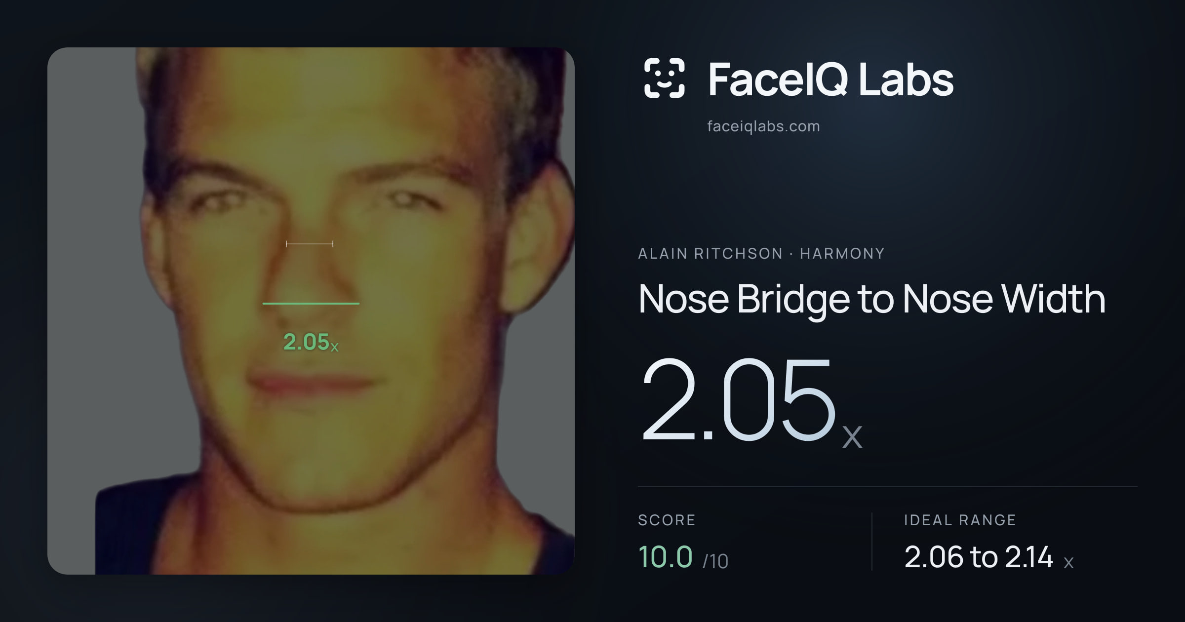 Alain Ritchson Nose Bridge to Nose Width: 2.05x, drawn on the photo