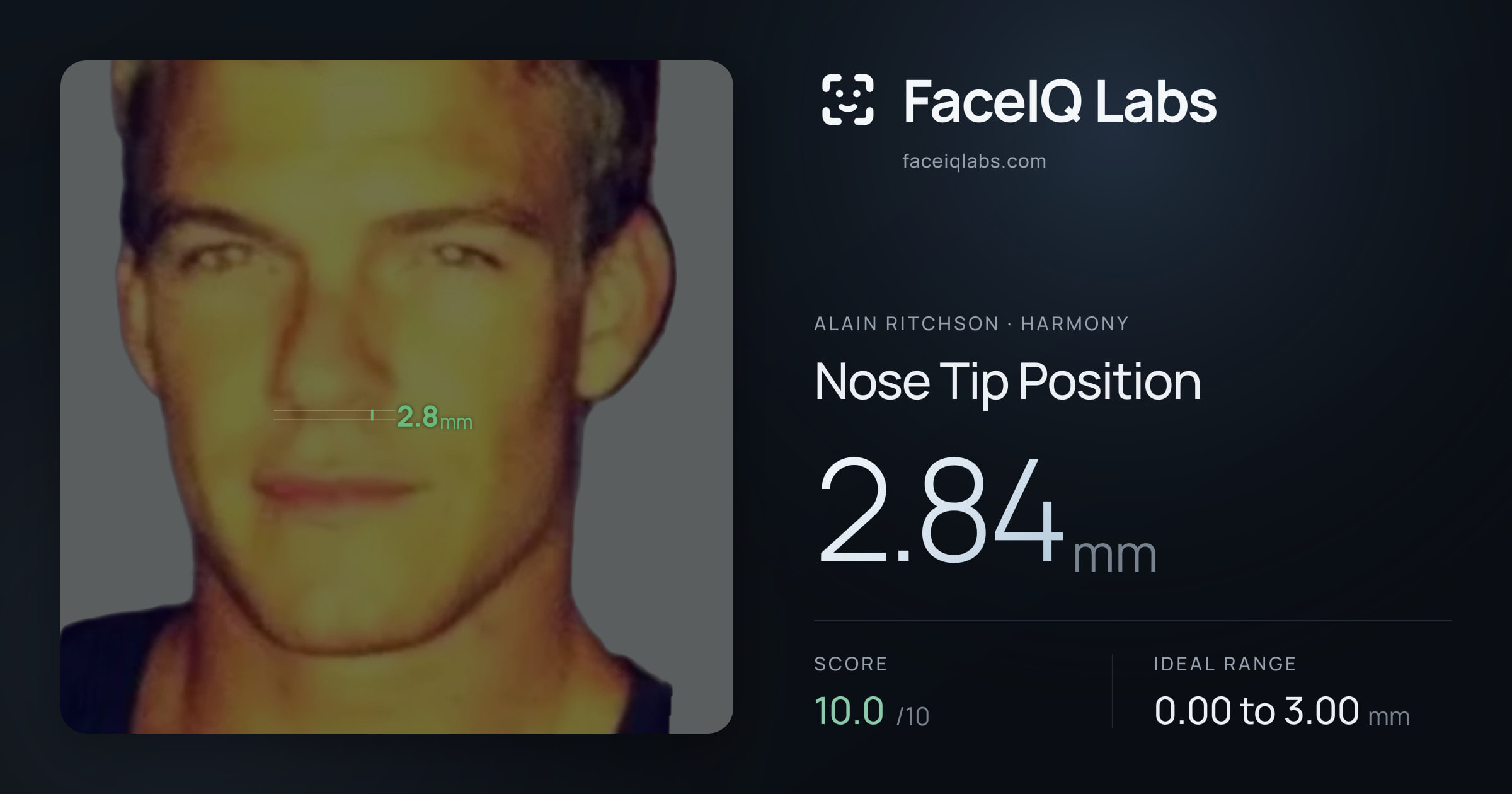Alain Ritchson Nose Tip Position: 2.84mm, drawn on the photo