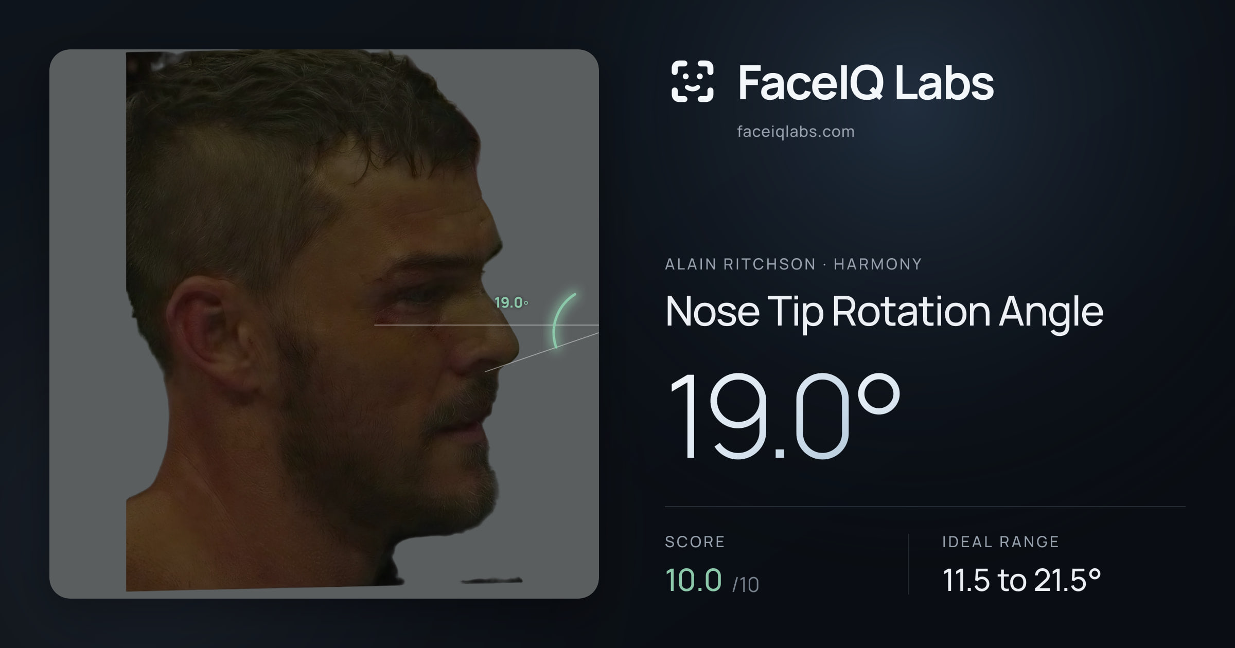 Alain Ritchson Nose Tip Rotation Angle: 19.0°, drawn on the photo
