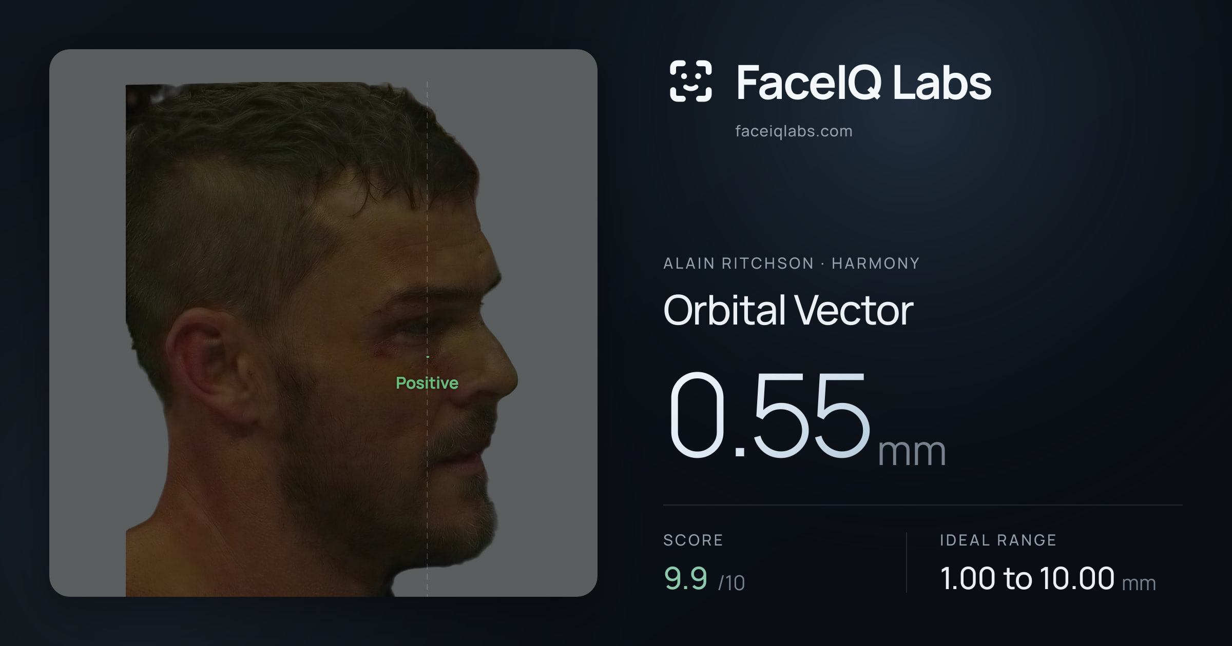 Alain Ritchson Orbital Vector: 0.55mm, drawn on the photo