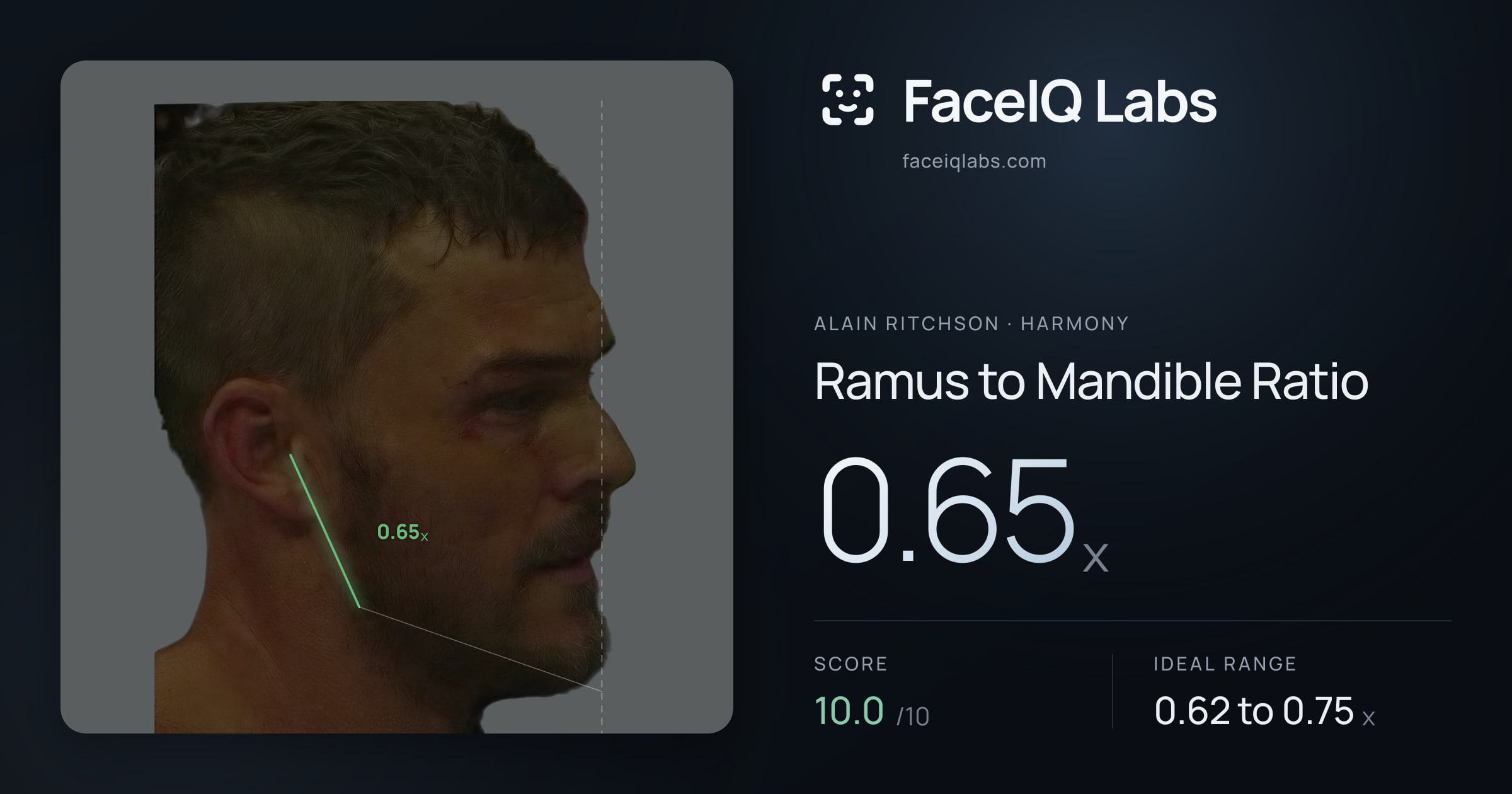 Alain Ritchson Ramus to Mandible Ratio: 0.65x, drawn on the photo