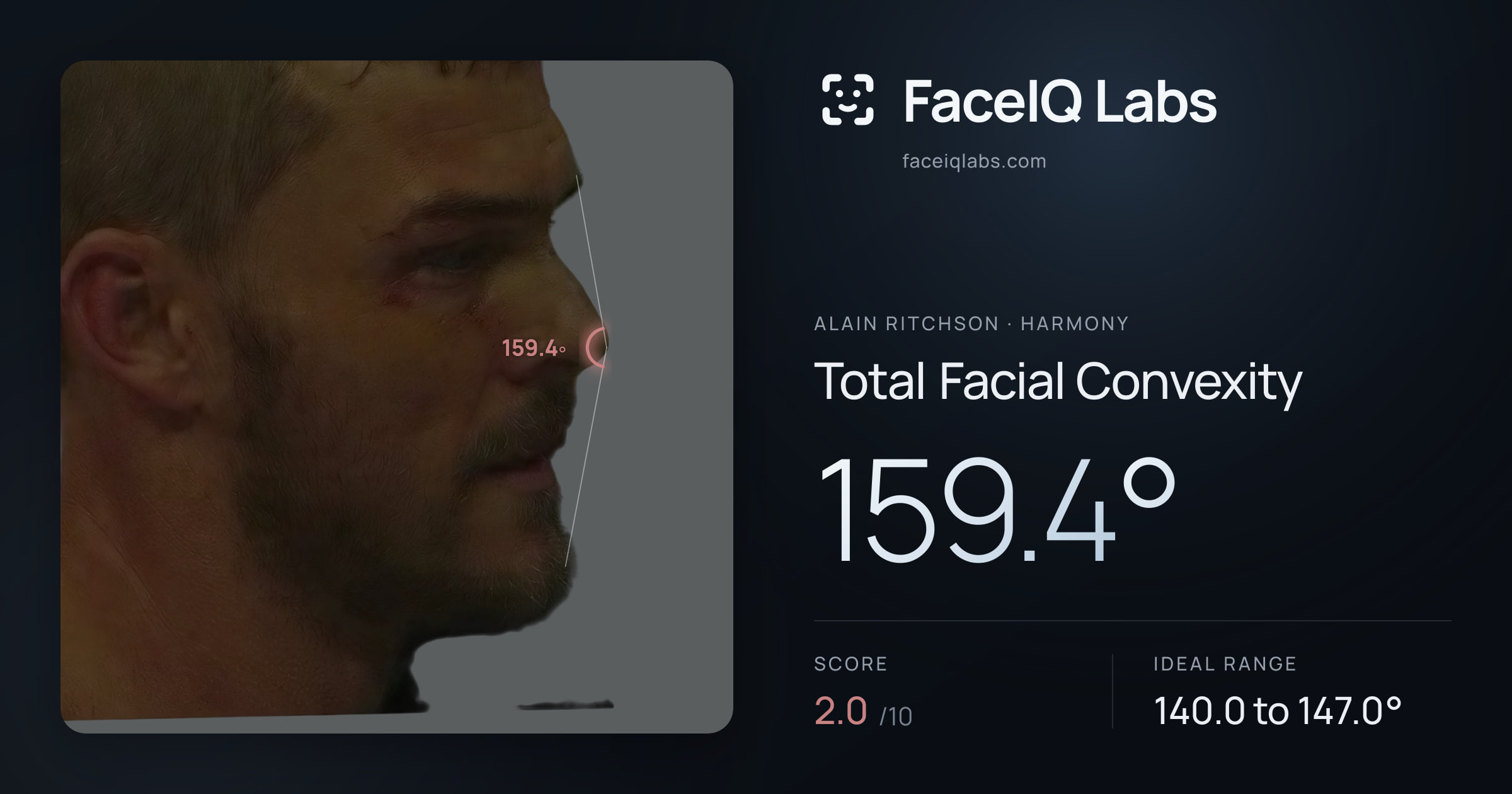 Alain Ritchson Total Facial Convexity: 159.4°, drawn on the photo