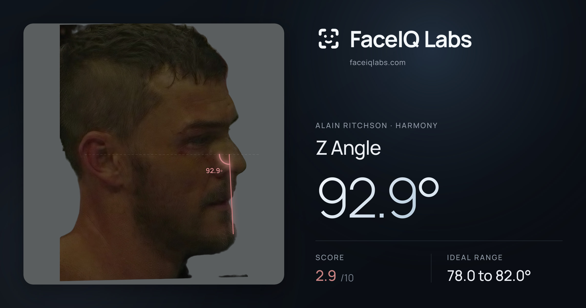 Alain Ritchson Z Angle: 92.9°, drawn on the photo